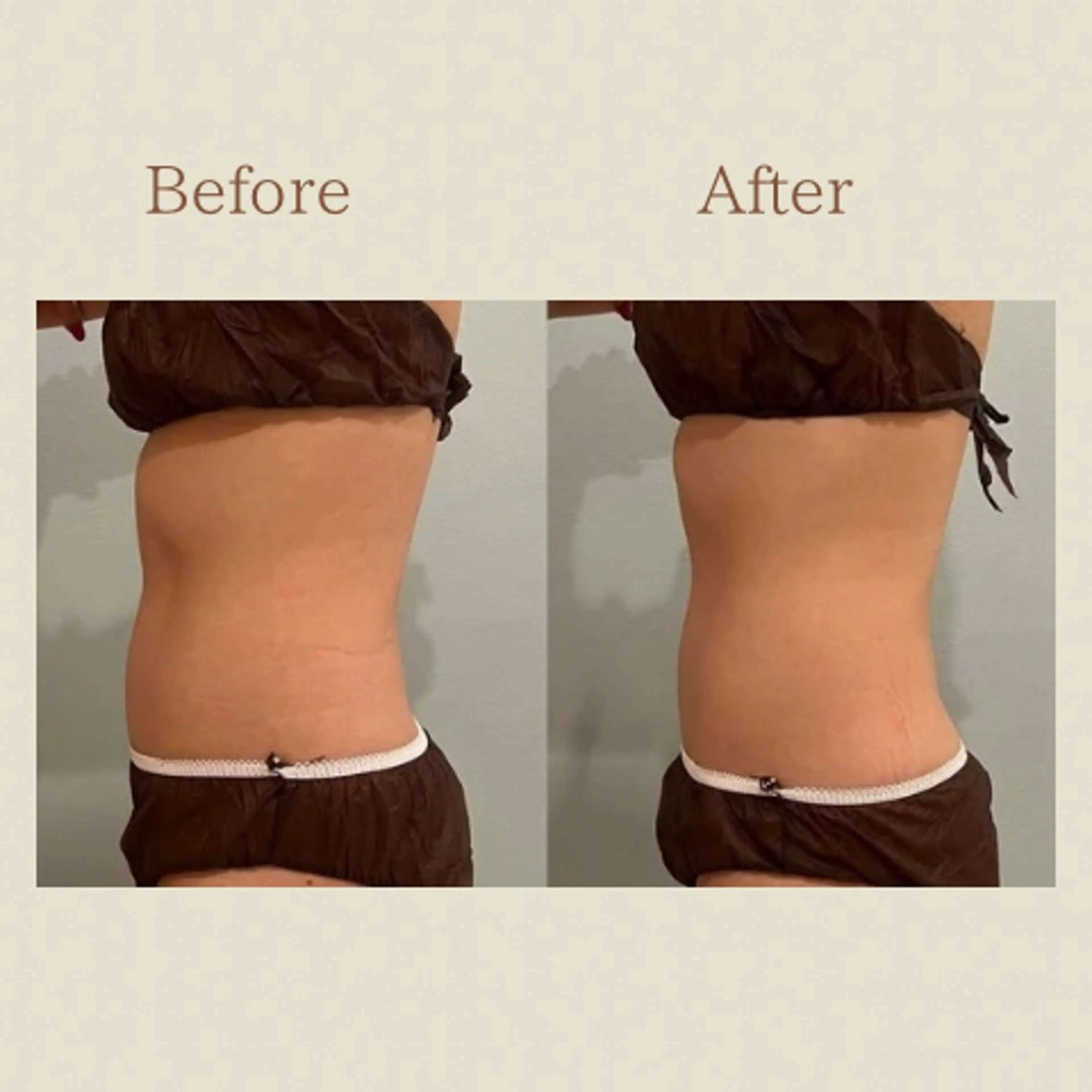 お腹痩せエステ Flat BELLY 恵比寿所属・【腸もみ/脂肪冷却】 お腹エステ/恵比寿のエステ・リラクイメージ
