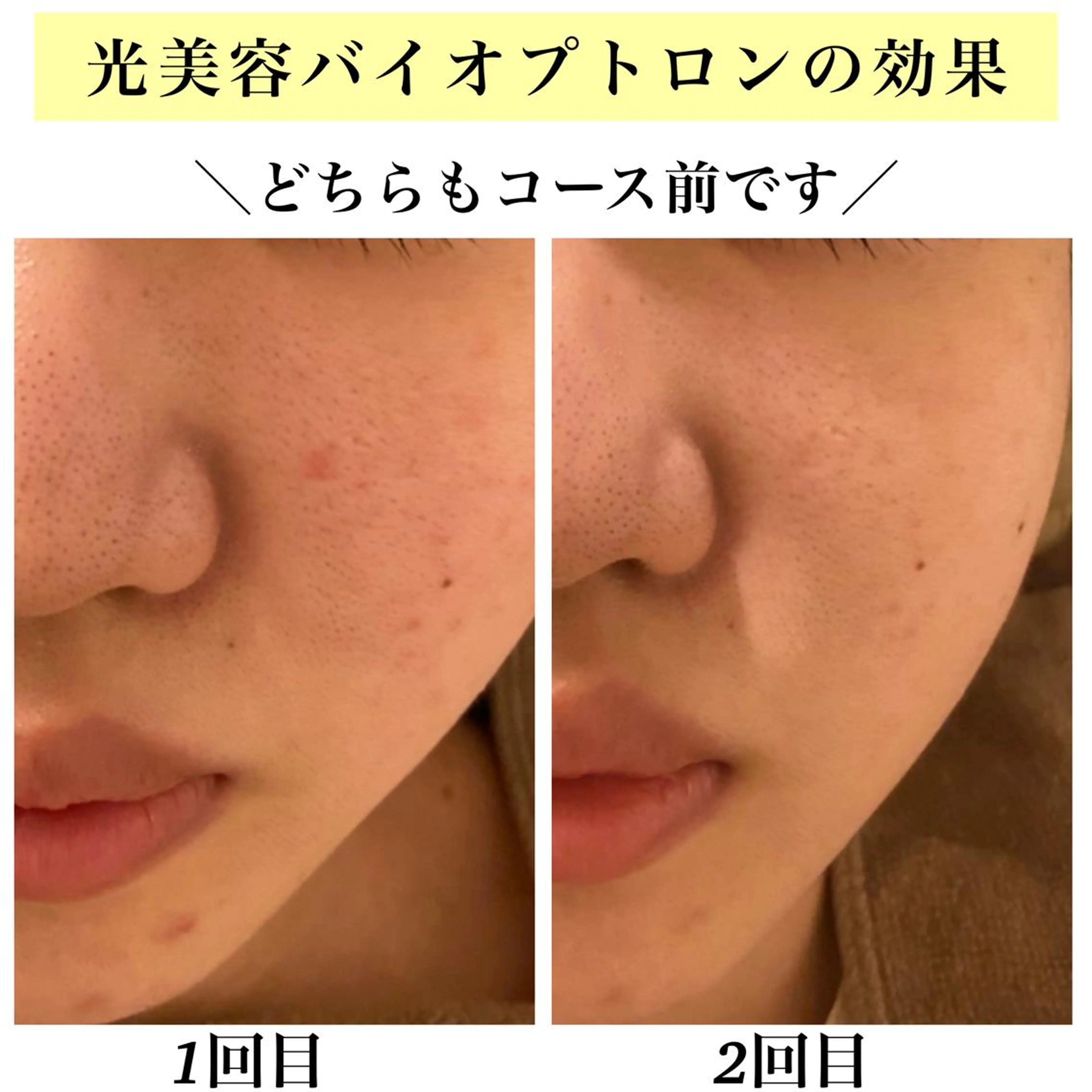 エステ リラク Bellesthe (ベルエステ)のエステ・リラクイメージ