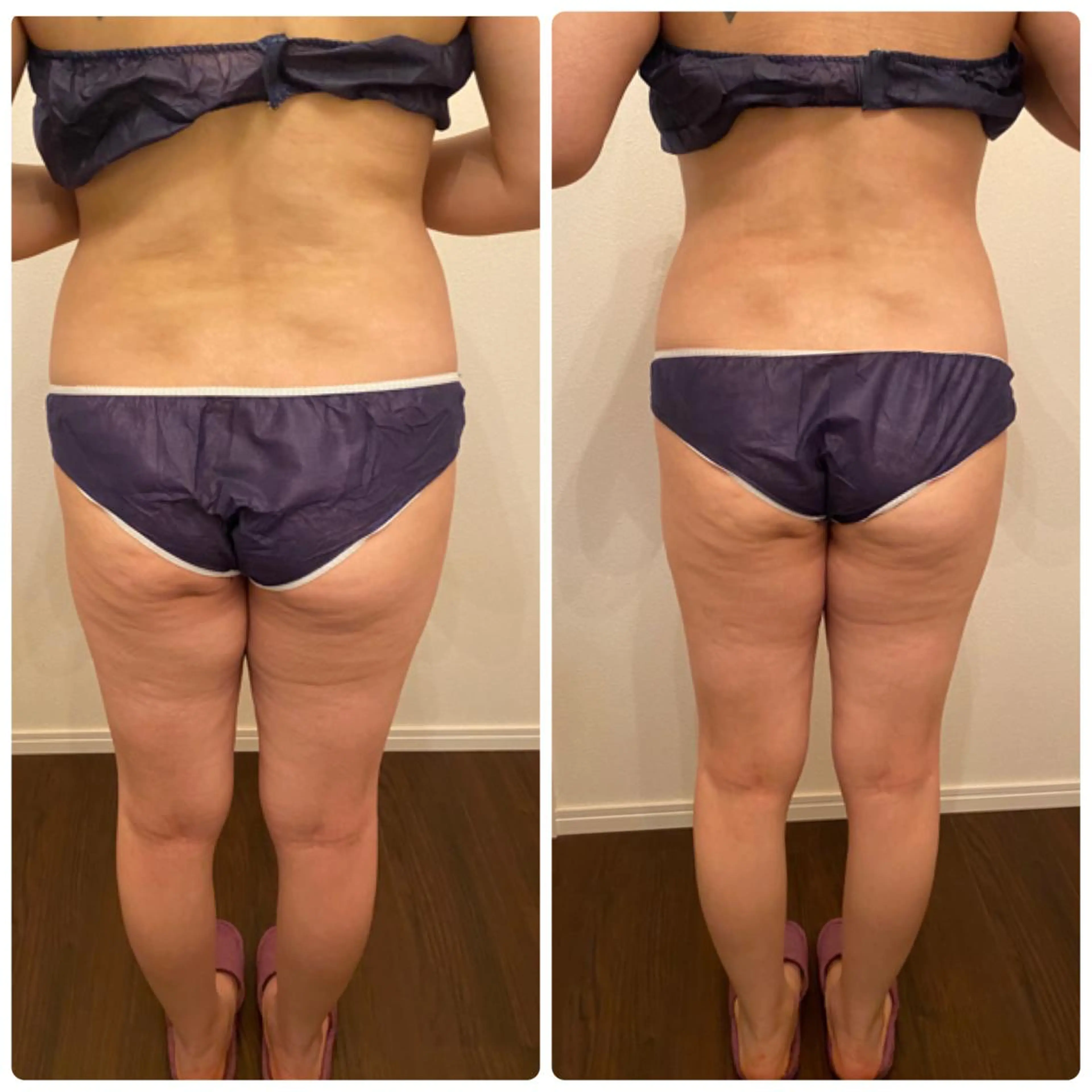 FLEUR大阪・整体 ・ハイフ・痩身・小顔のエステ・リラクイメージ