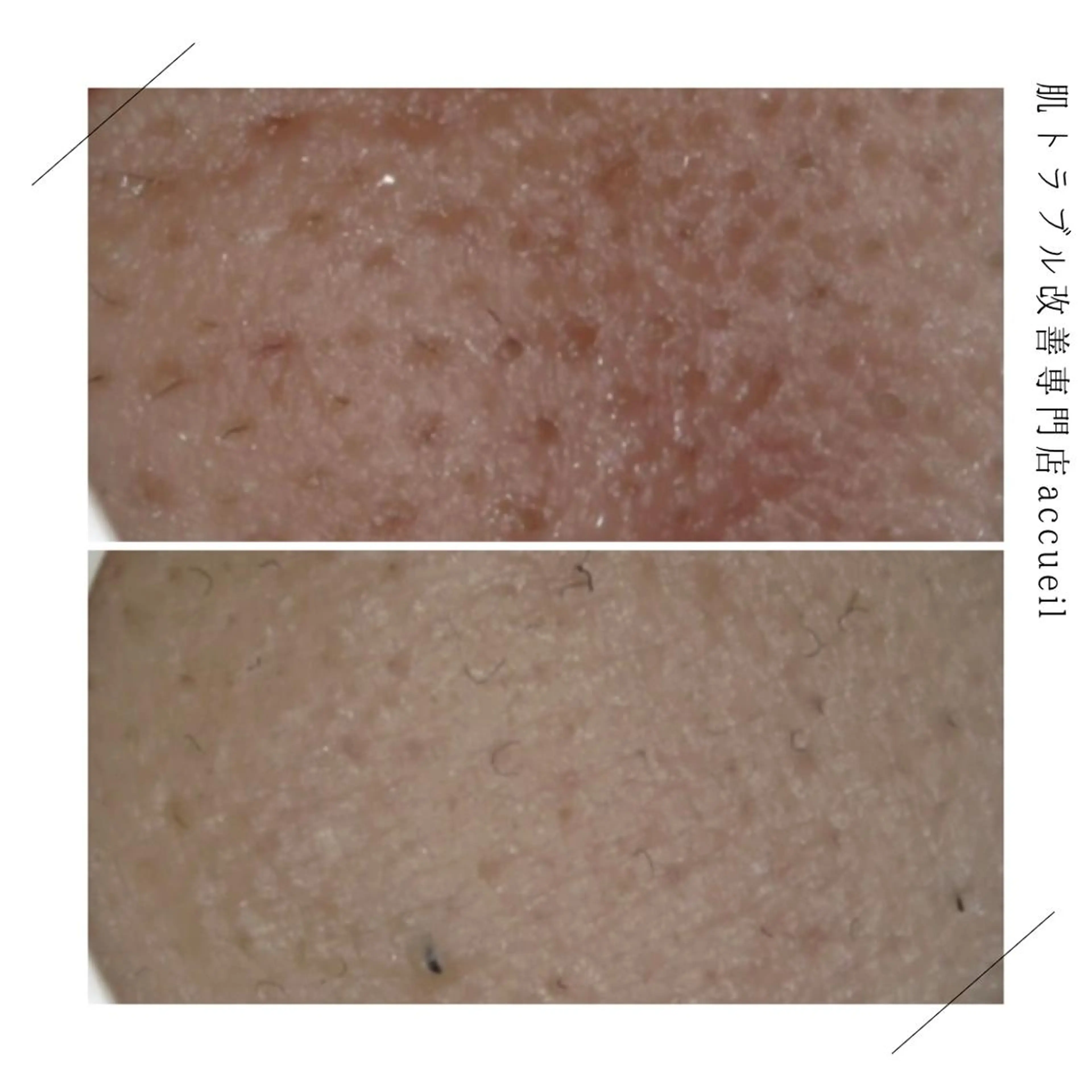 ロング カラー パーマ ヘアアレンジ メンズ キッズ ネイル マツエク・マツパ アイブロウ 触れたくなる モテ肌へ...❤︎のエステ・リラクイメージ