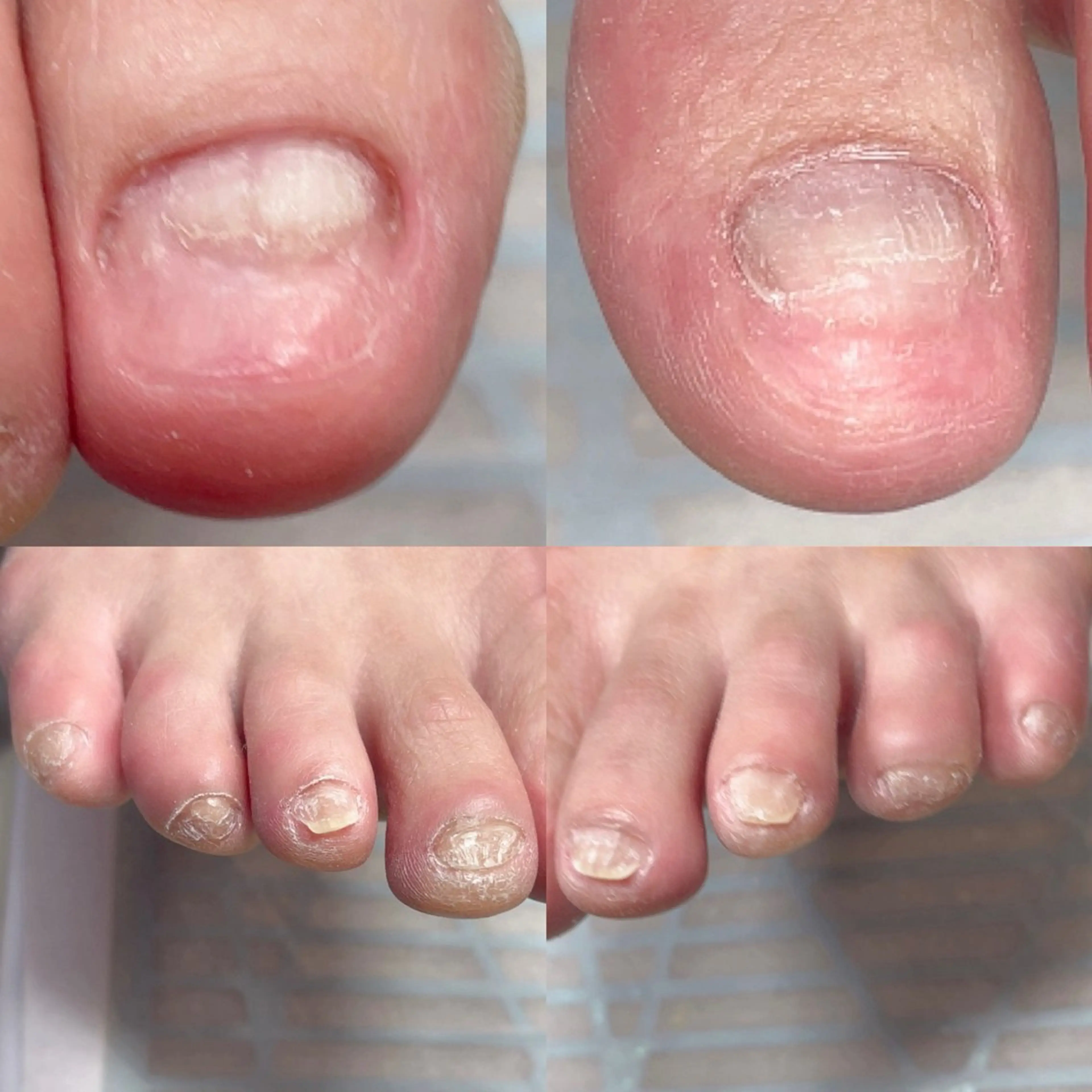 ネイル フットネイル フットネイル .Nails Mio 赤羽西ネイルサロンのネイルデザイン