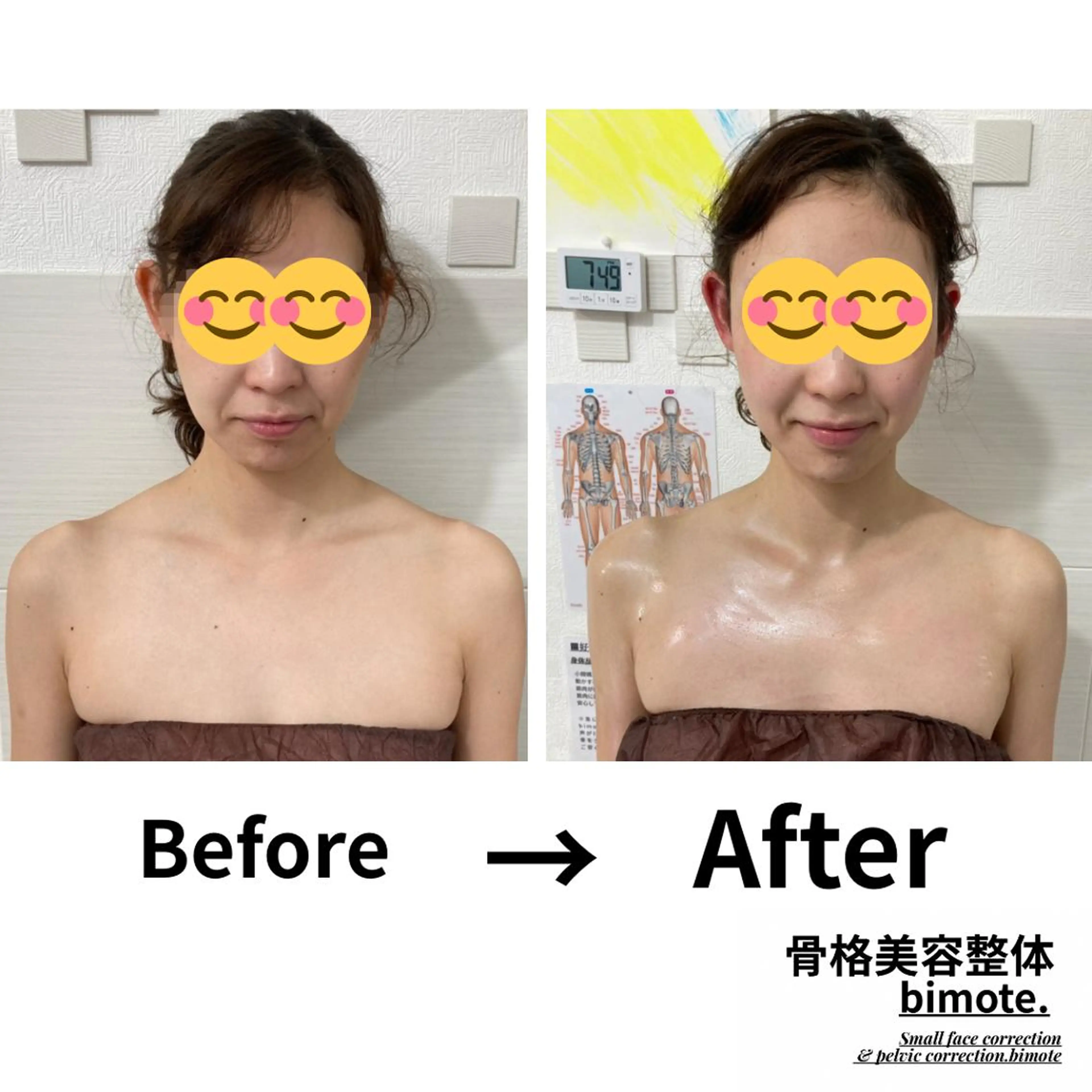 新規女性限定🍀骨格＋全身リンパマッサージ＋筋膜リリース＝即効果❗『肩こり』『全身疲労』『痩身』『ブライダル』✨90分✨の写真