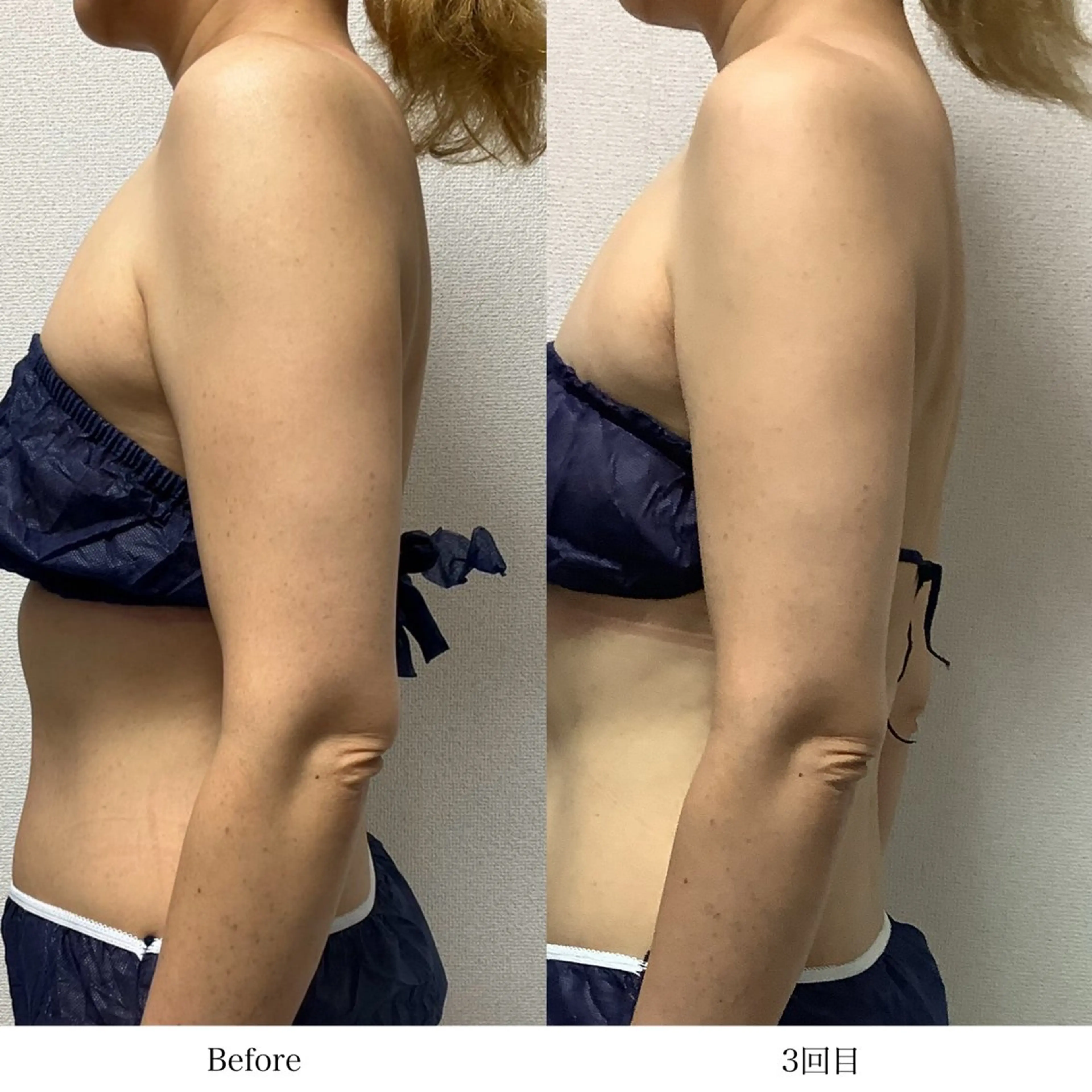 冷却専門店 SLARIのエステ・リラクイメージ