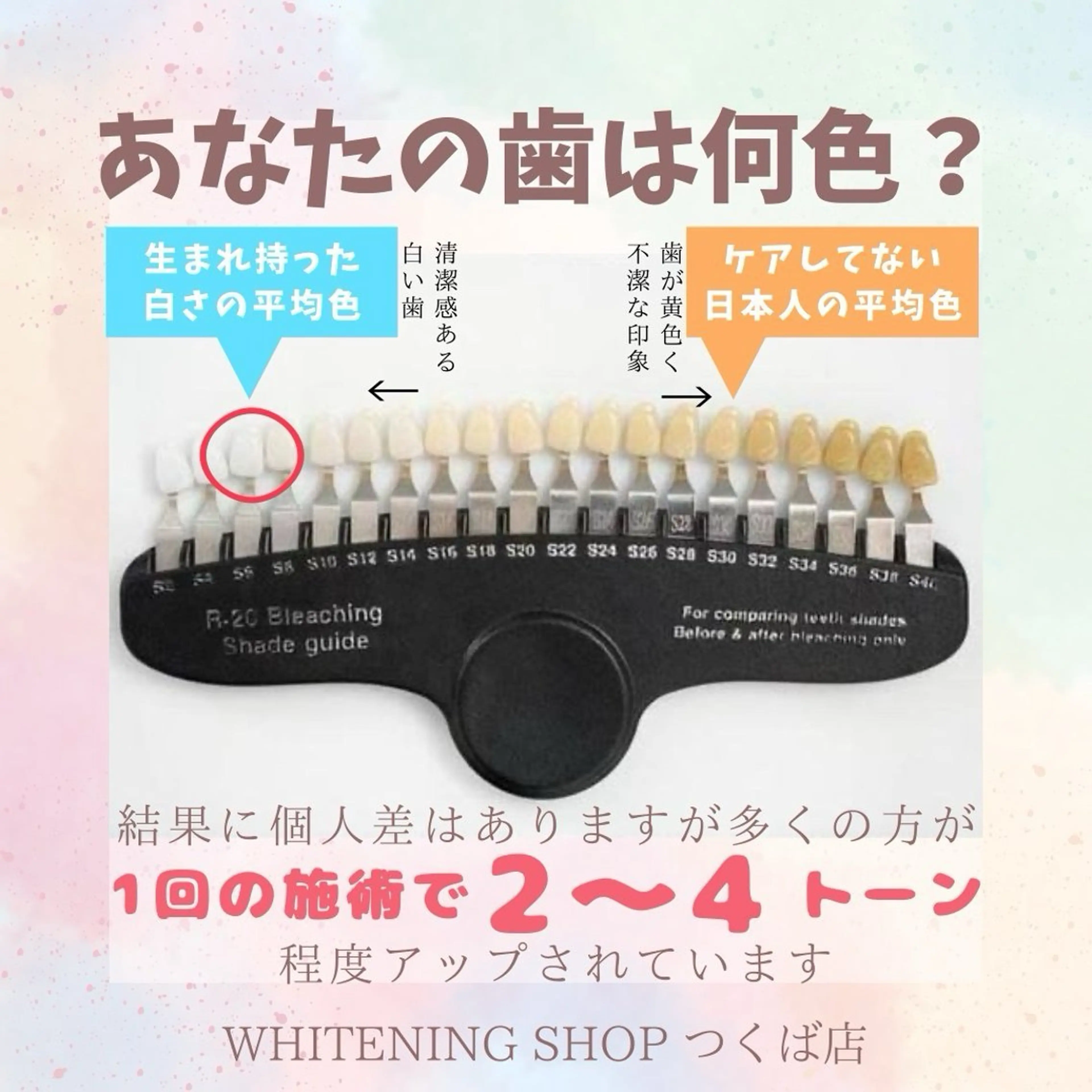ホワイトニングショップつくば店所属・ホワイトニング ショップつくば店のその他イメージ