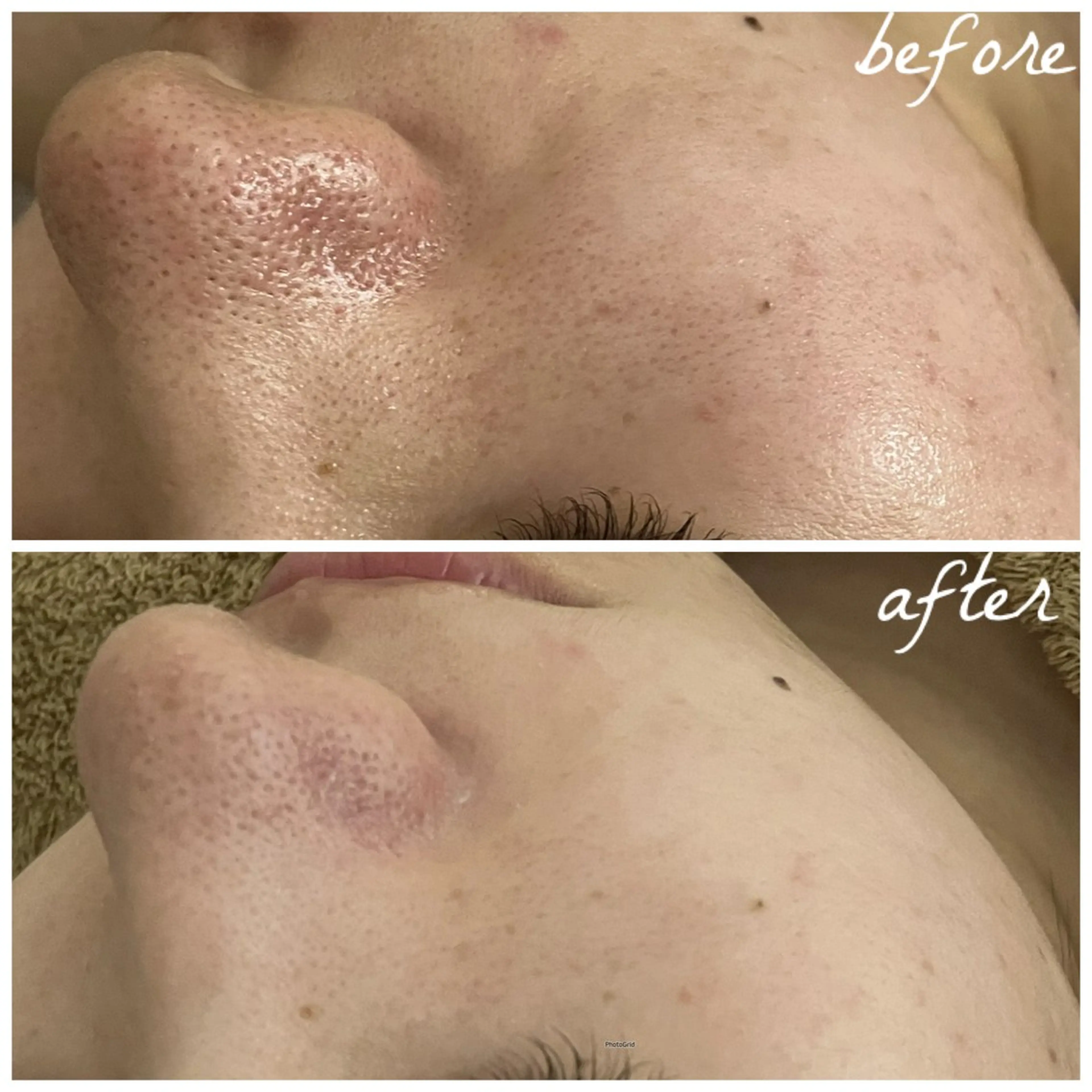 メンズ メナード岐阜茜部 杉浦のエステ・リラクイメージ