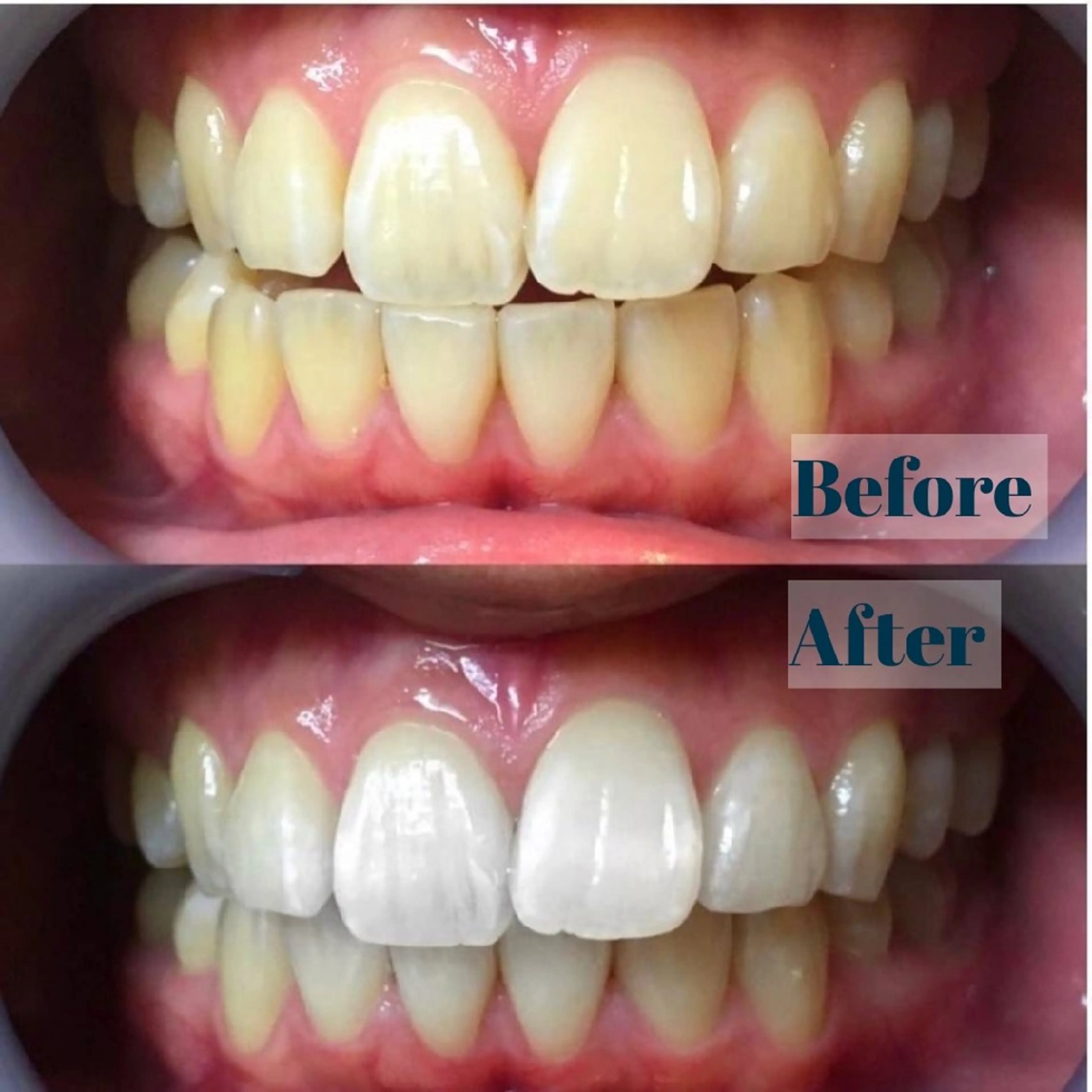 エステ リラク LBS吉祥寺 公式のエステ・リラクイメージ