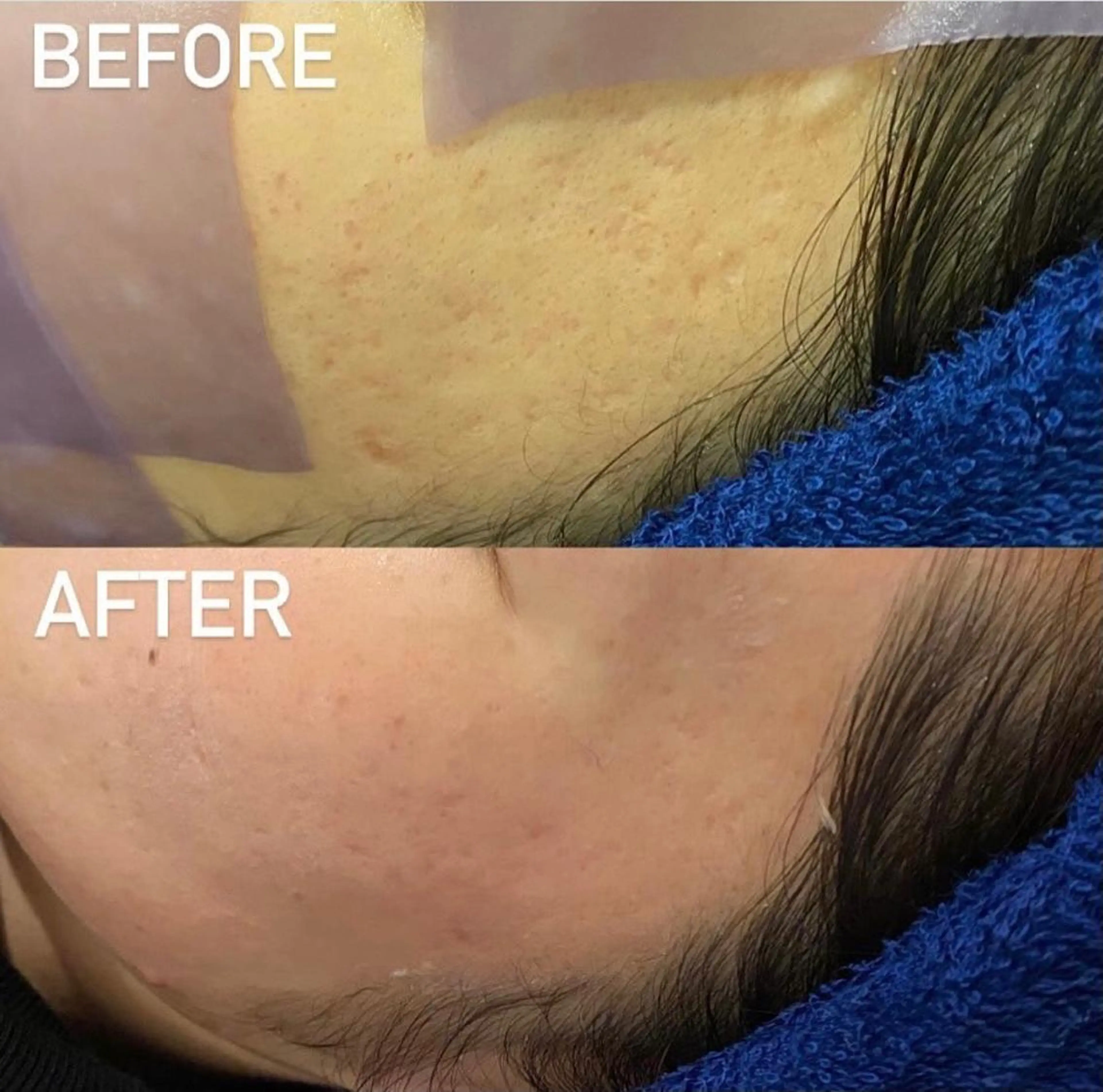 エステ リラク NANI OAFU所属・NANIOAFU [なんば店］のその他イメージ