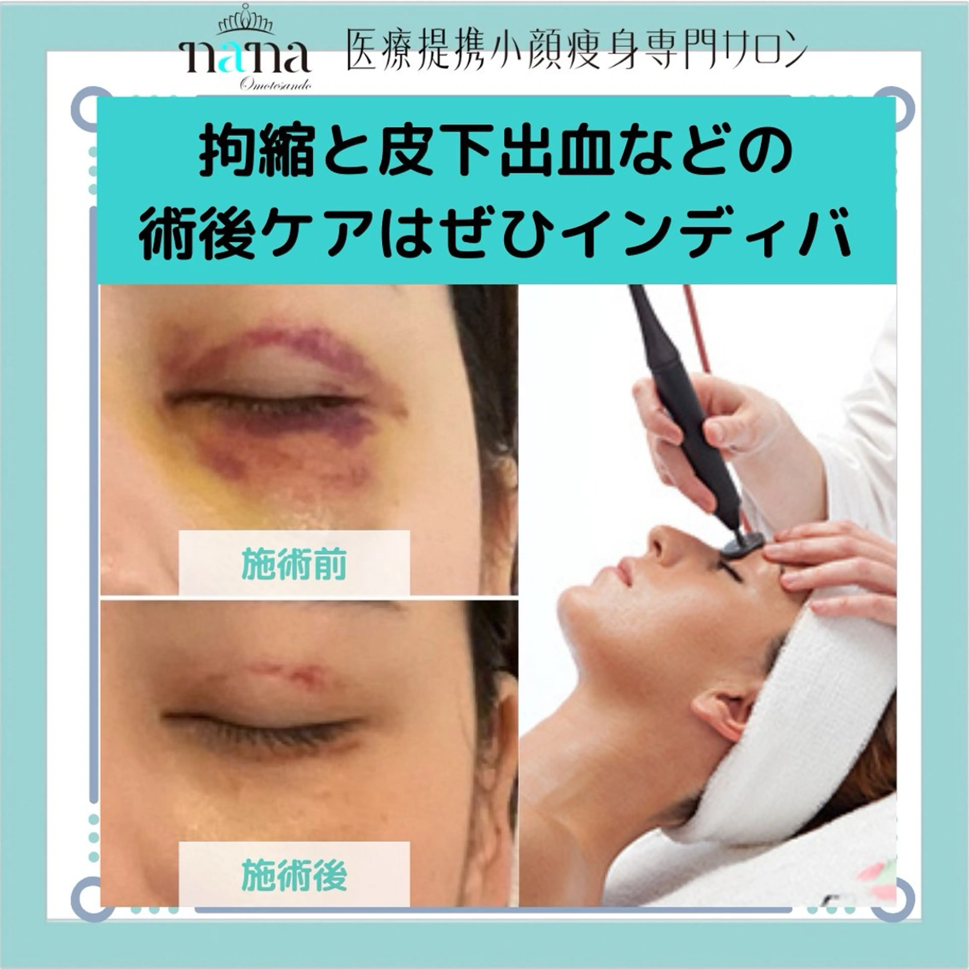 エステ リラク 小顔痩身インディバ Nana表参道のエステ・リラクイメージ