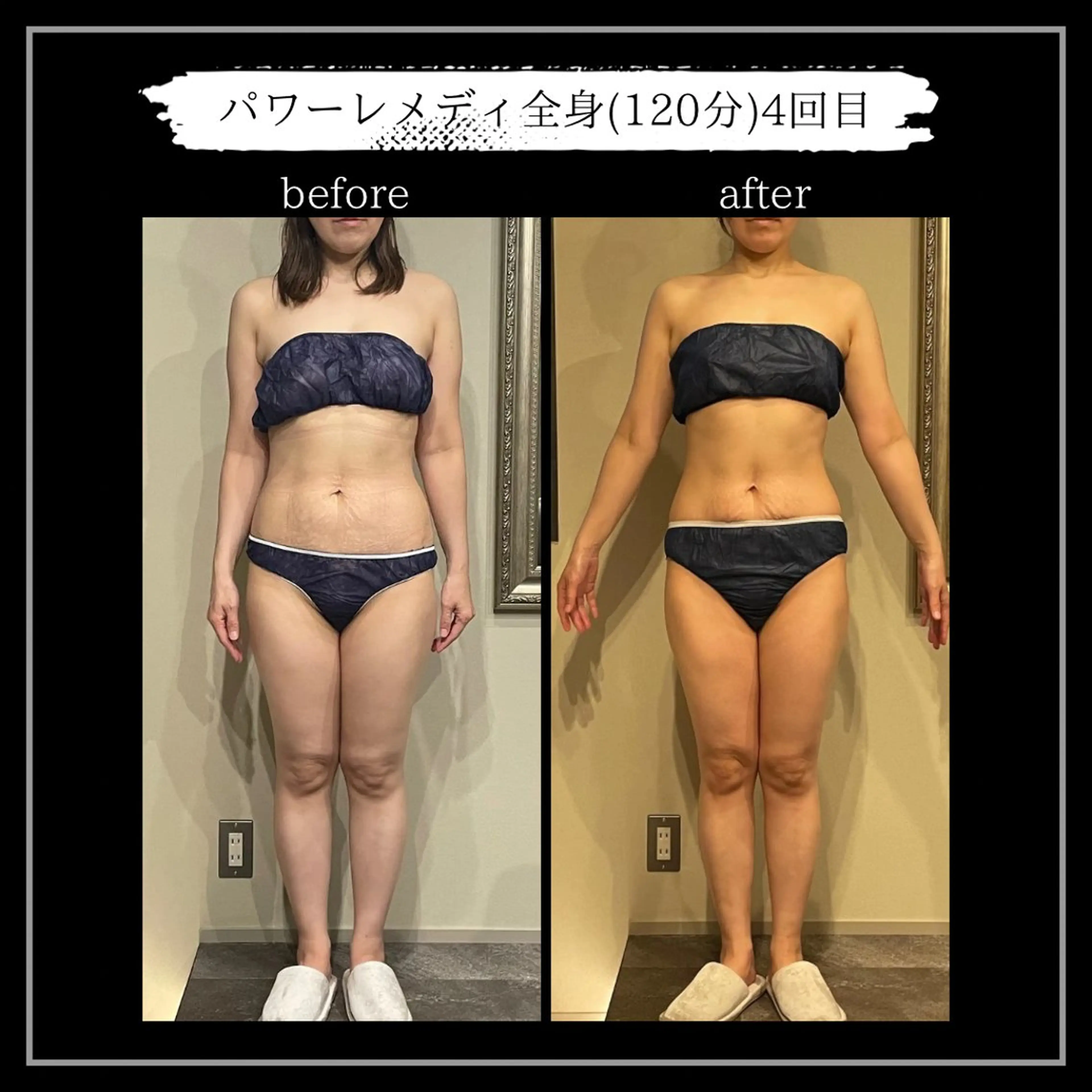 オフ:オン所属・オフ:オン 全身筋膜マッサージのエステ・リラクイメージ