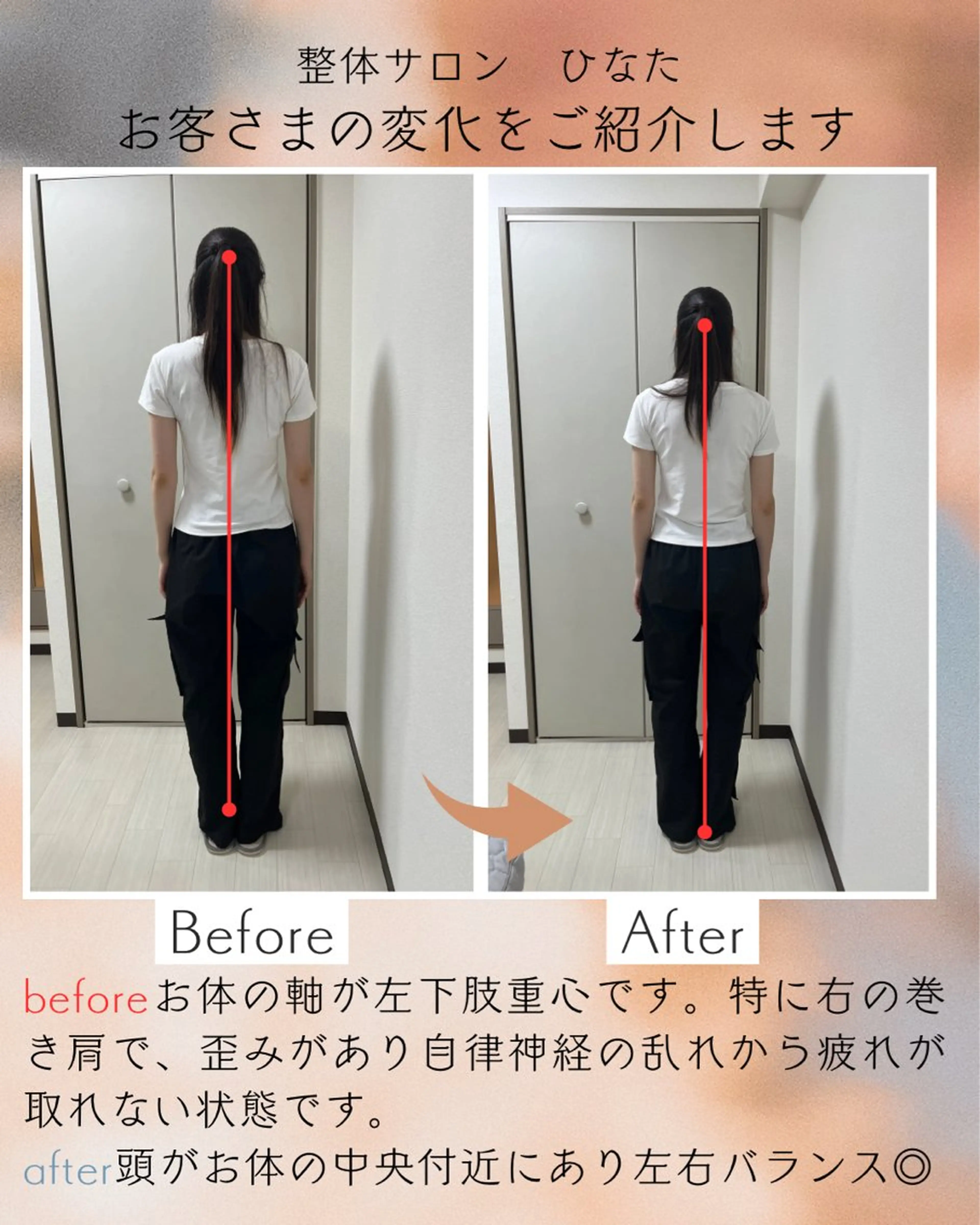 整体サロン　ひなた~HINATA~ 　京阪七条　京都店所属・肩こり反り腰改善専門 筋膜✨整体ひなたのエステ・リラクイメージ