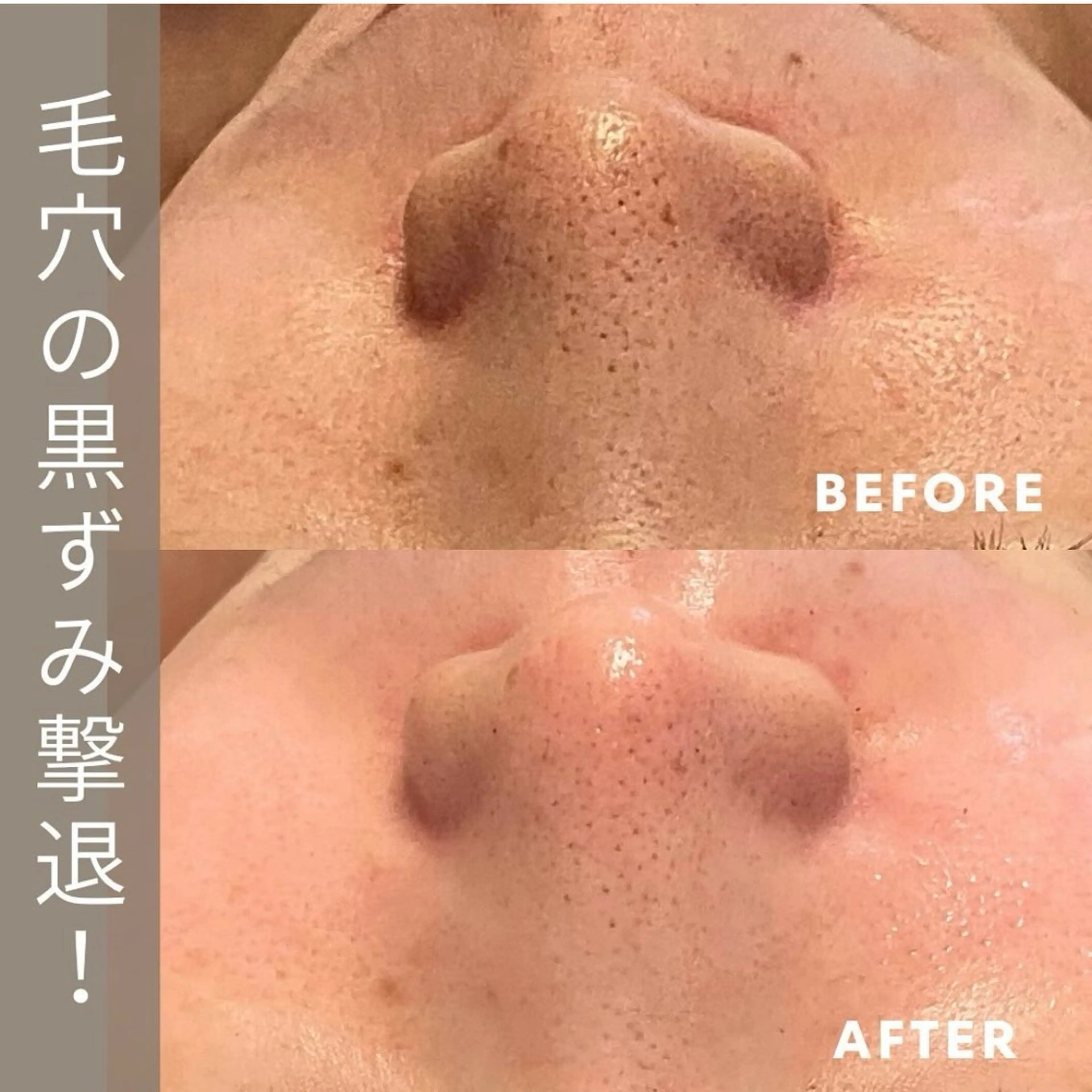 小林 千紘のエステ・リラクイメージ
