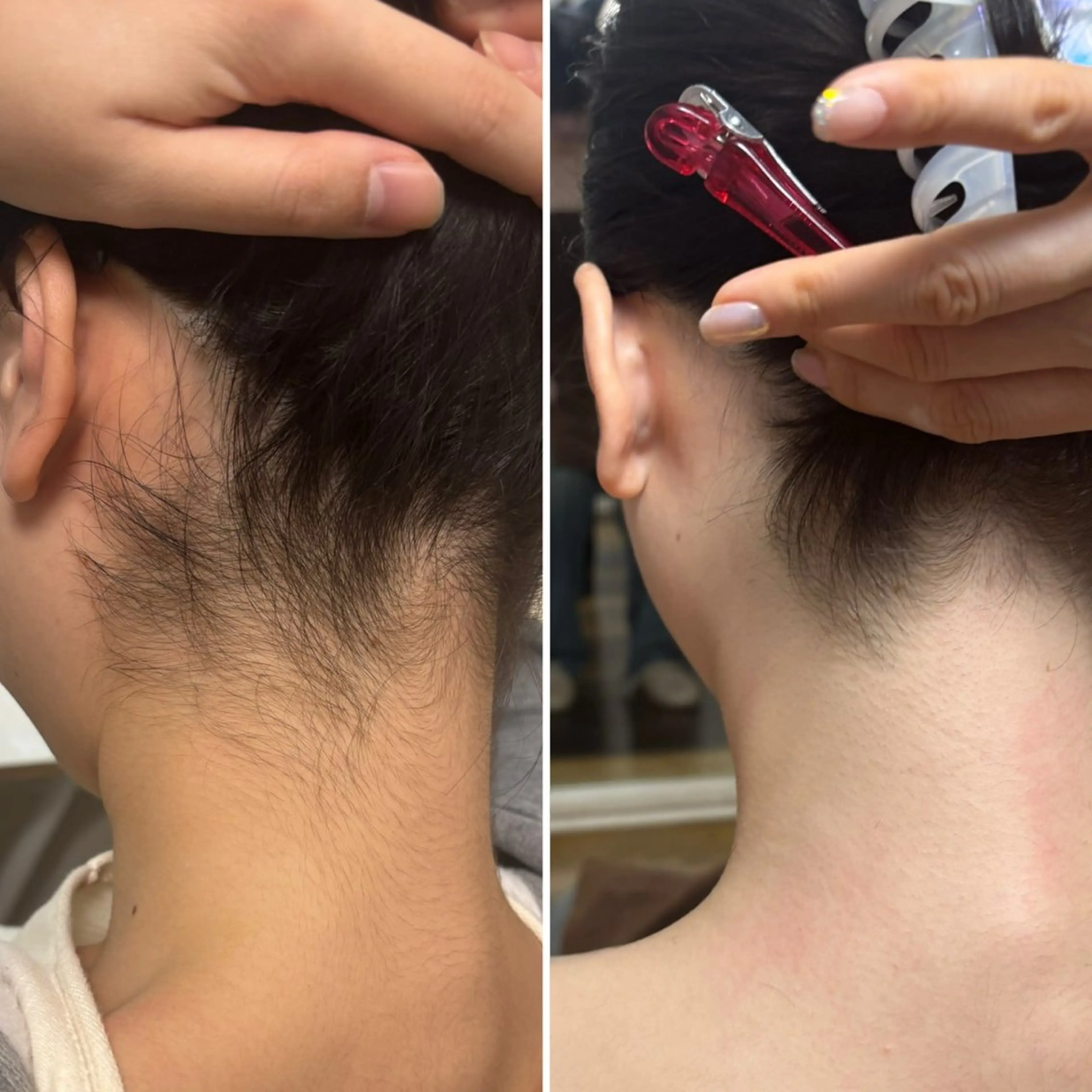 脱毛 透明感の肌Lino malieのエステ・リラクイメージ