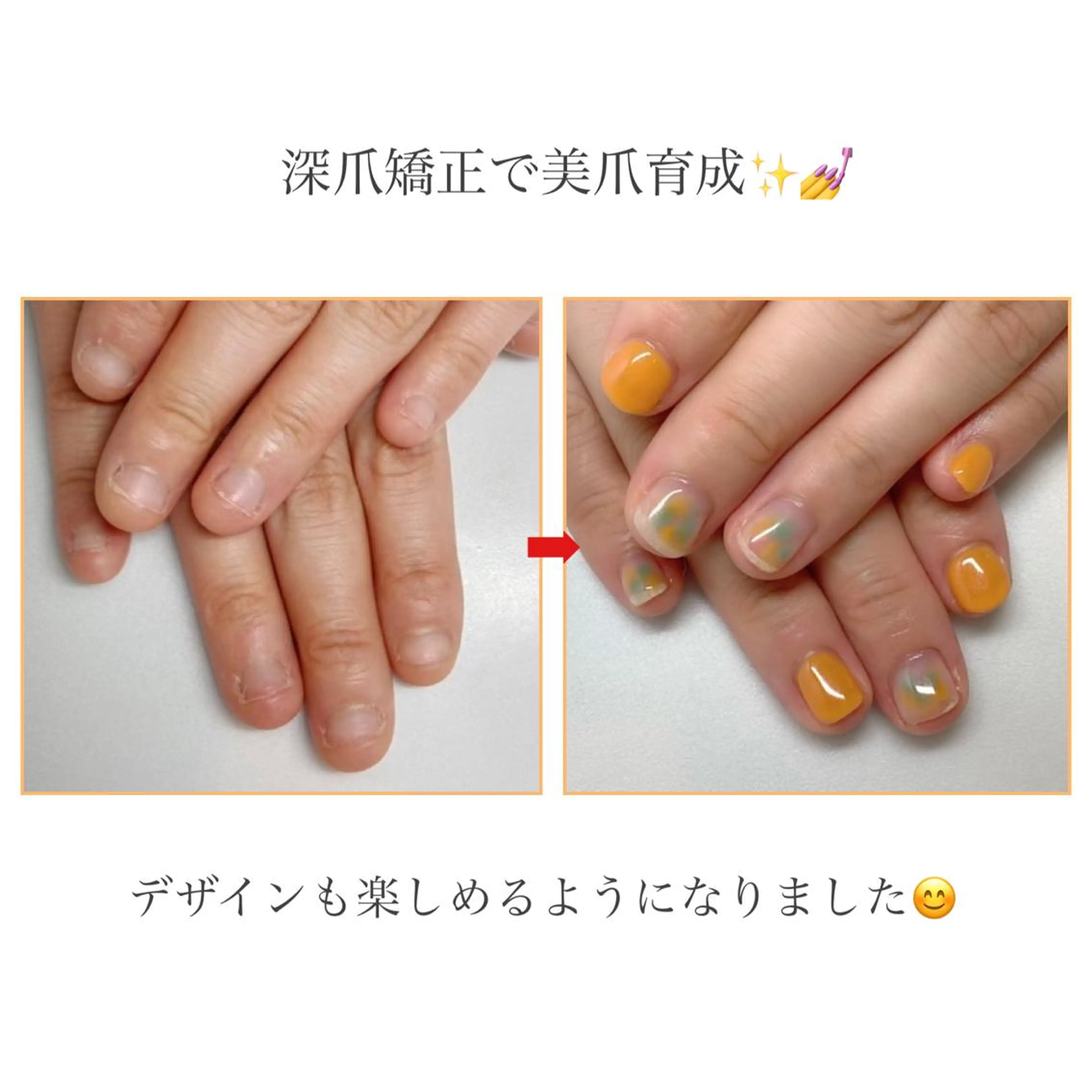 ネイル ネイルサロンアリューム所属・ネイルサロン アリュームのネイルデザイン