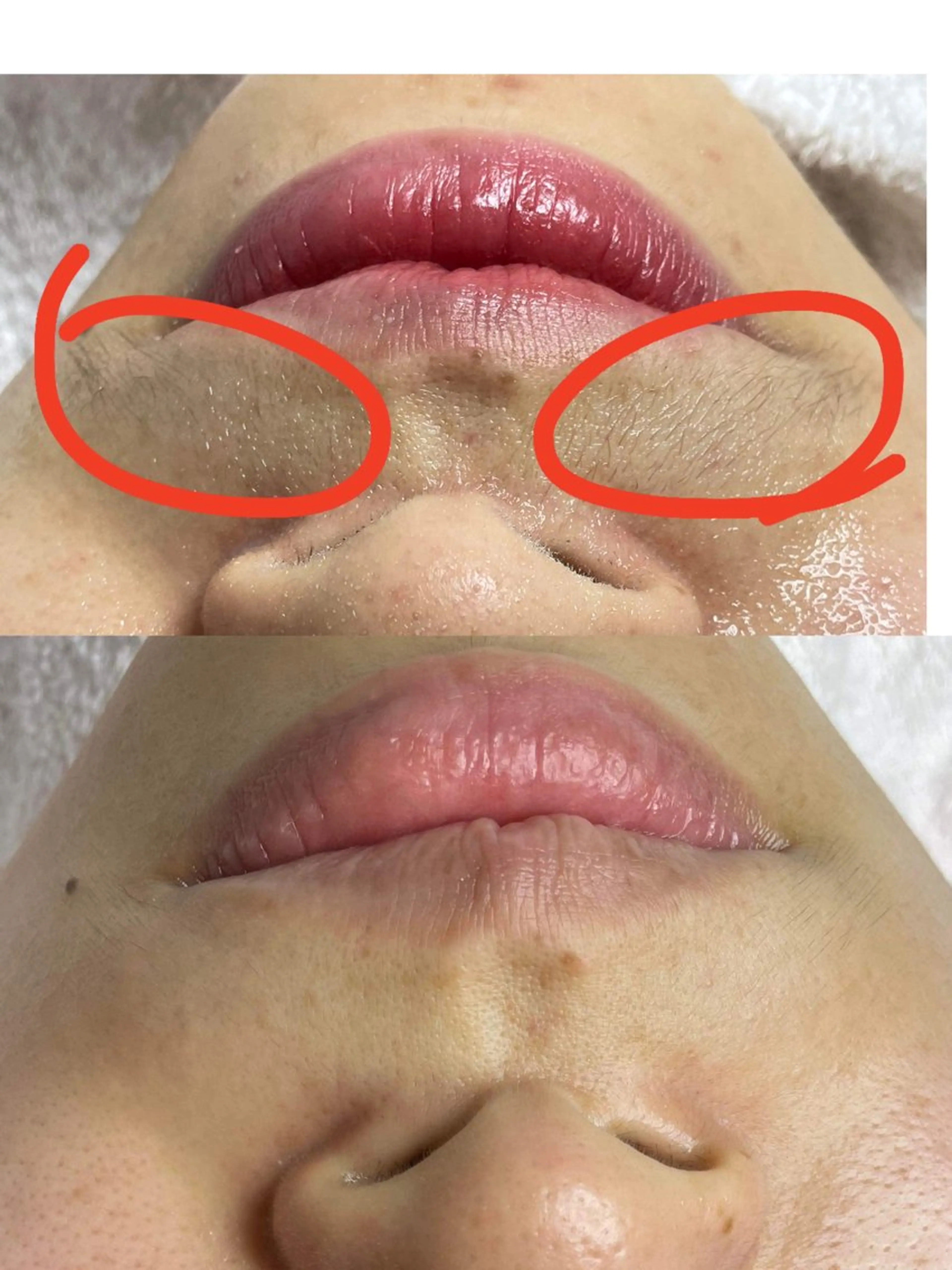 エステ ニキビ、痩身、脱毛、 サクラチャンスパのエステ・リラクイメージ