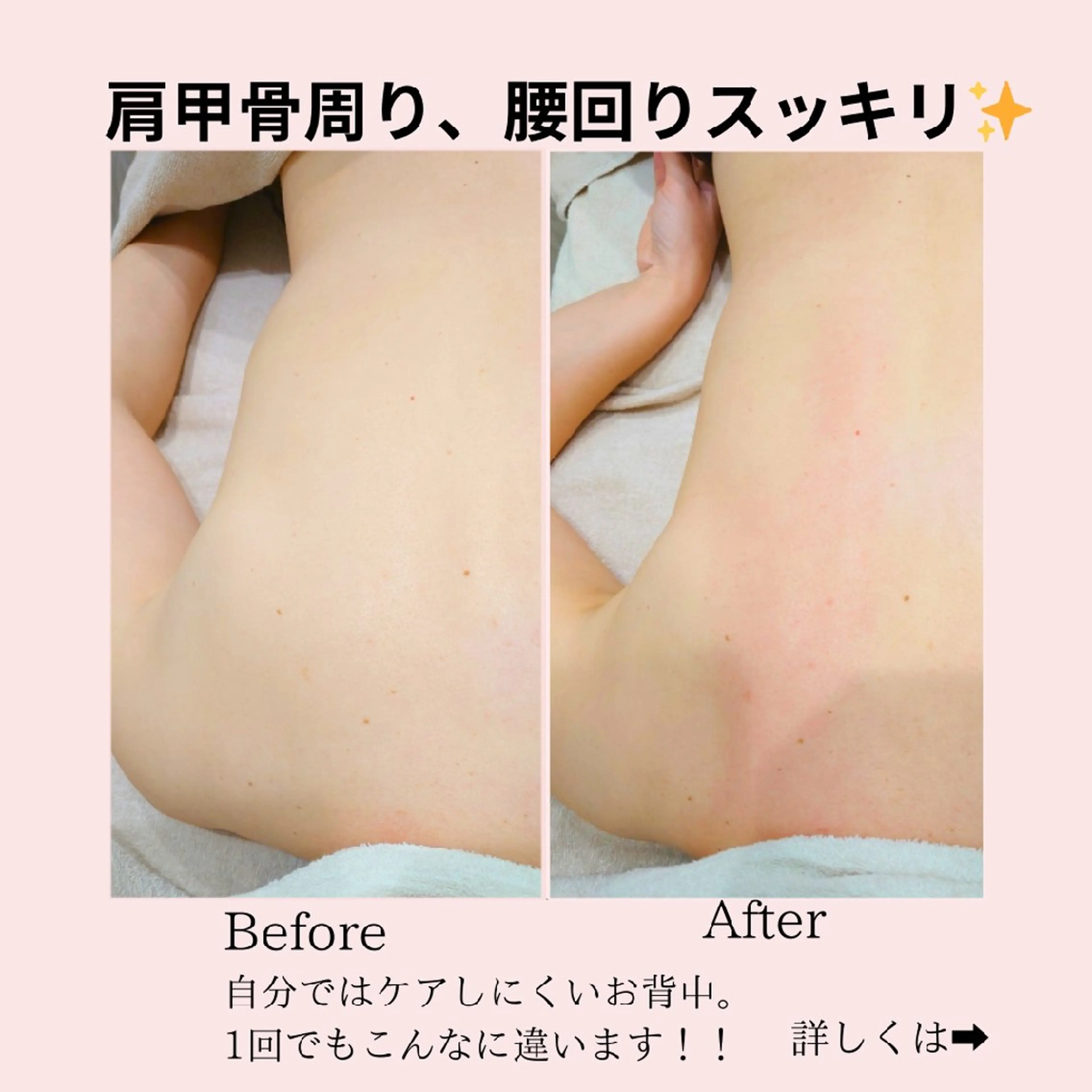 PRETTIEST SHINE所属・山田 浩子のエステ・リラクイメージ