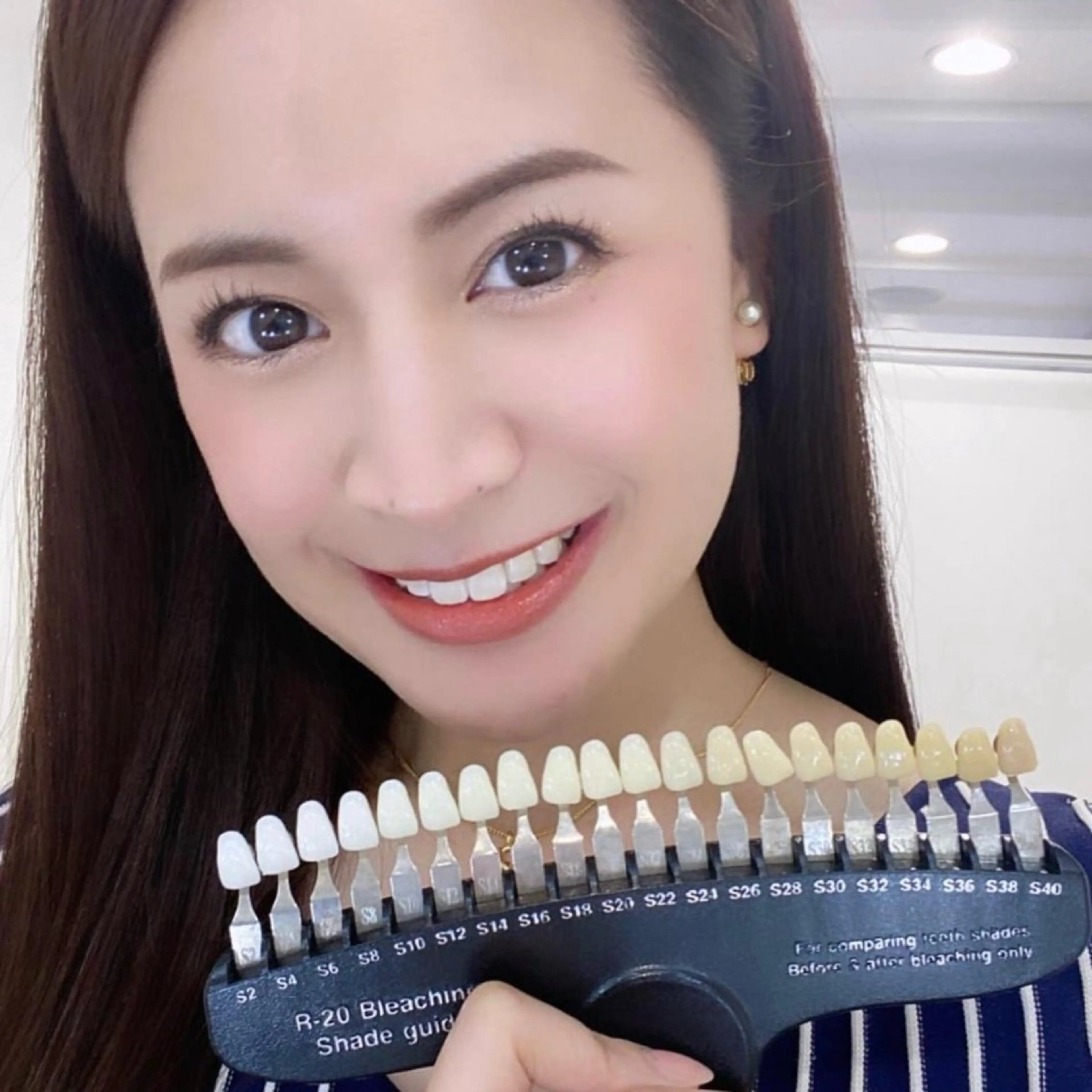 【初回限定・お得なお試し価格】まずはお試し💁‍♀️セルフホワイトニング〈8分×2回〉🥺✨平均1​〜​2トーンアップ✨の写真