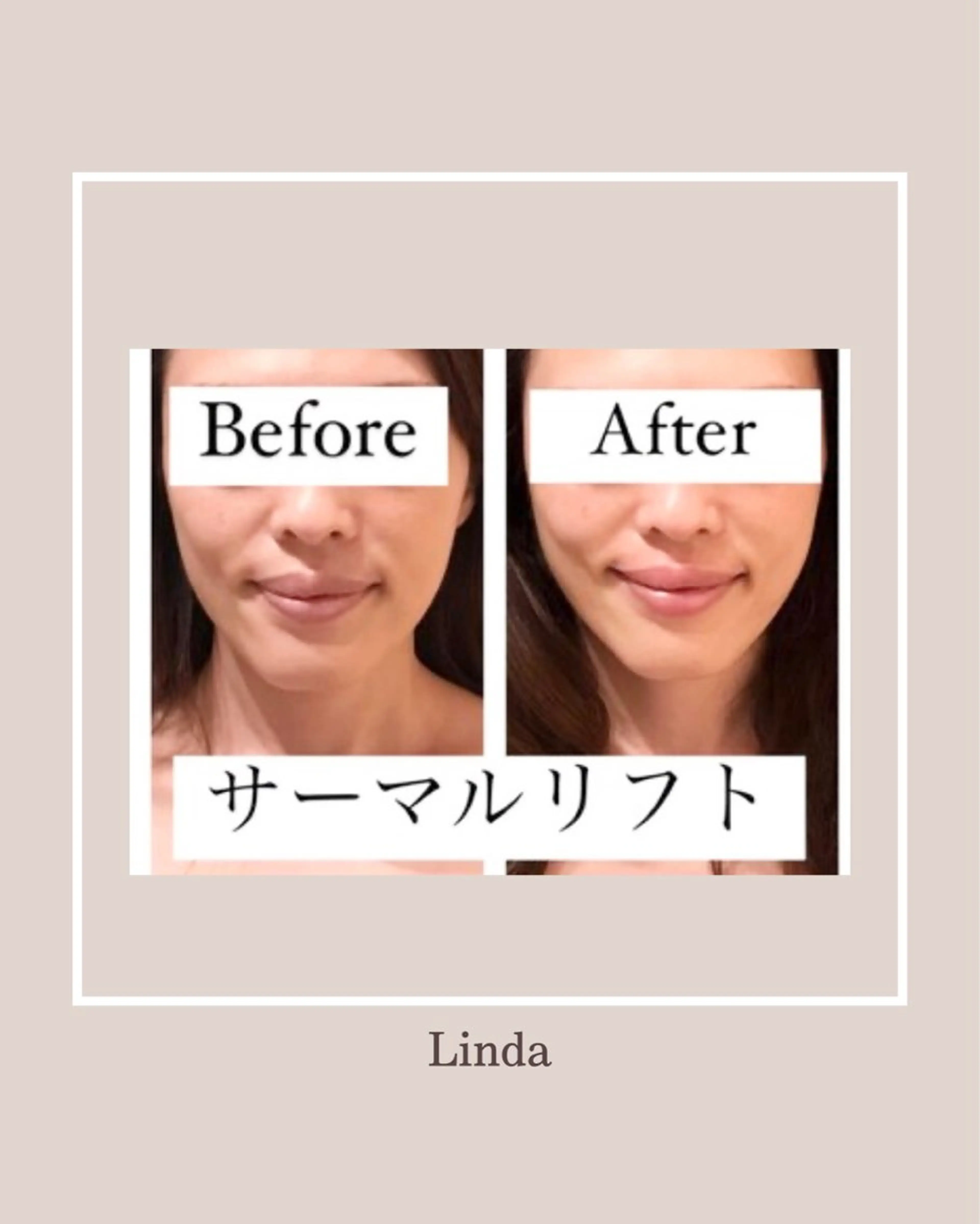 エステ アイラッシュ&エステサロンLinda西宮所属・小顔&肌質改善 LINDA西宮 AIのエステ・リラクイメージ