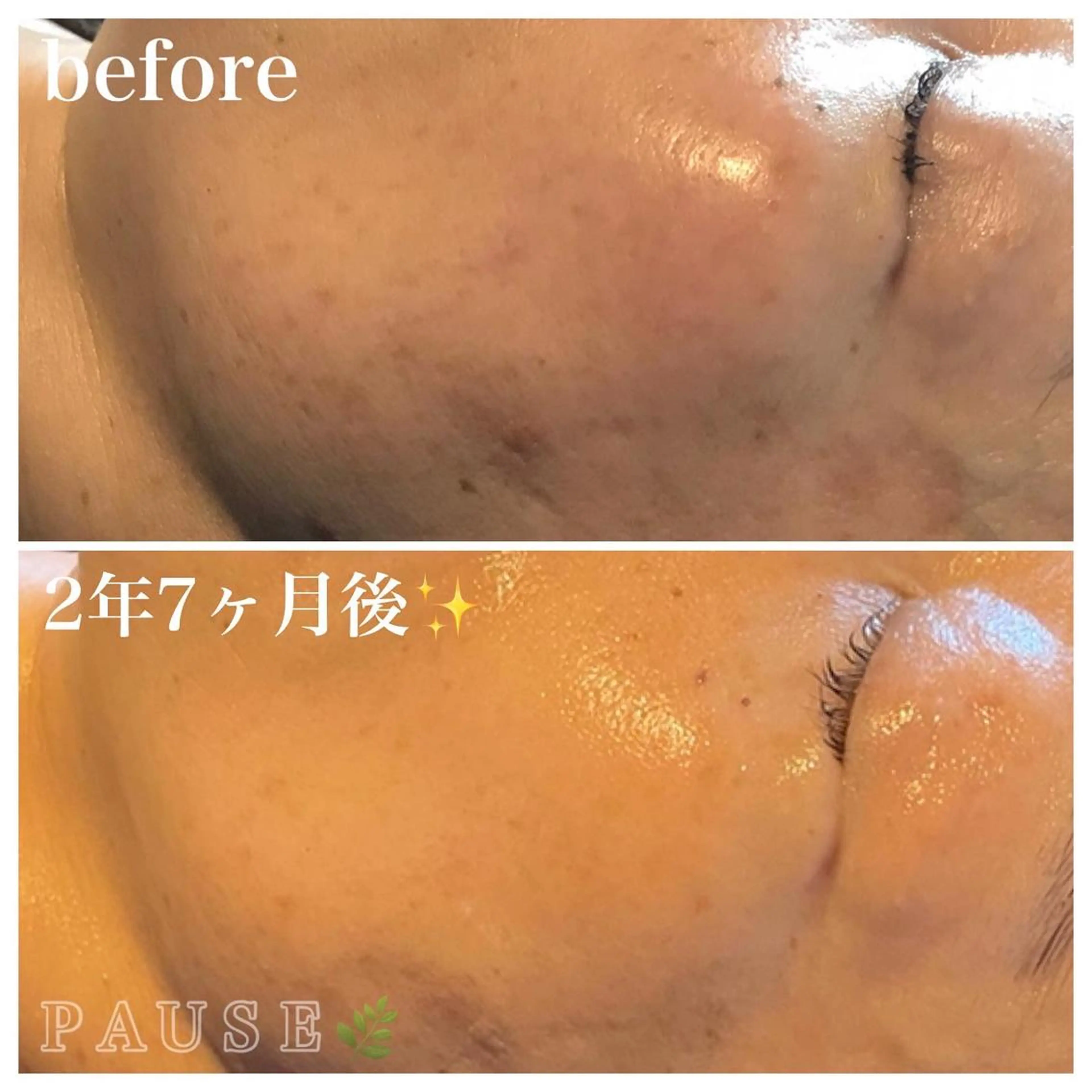 エステ 浜野 恵美のエステ・リラクイメージ