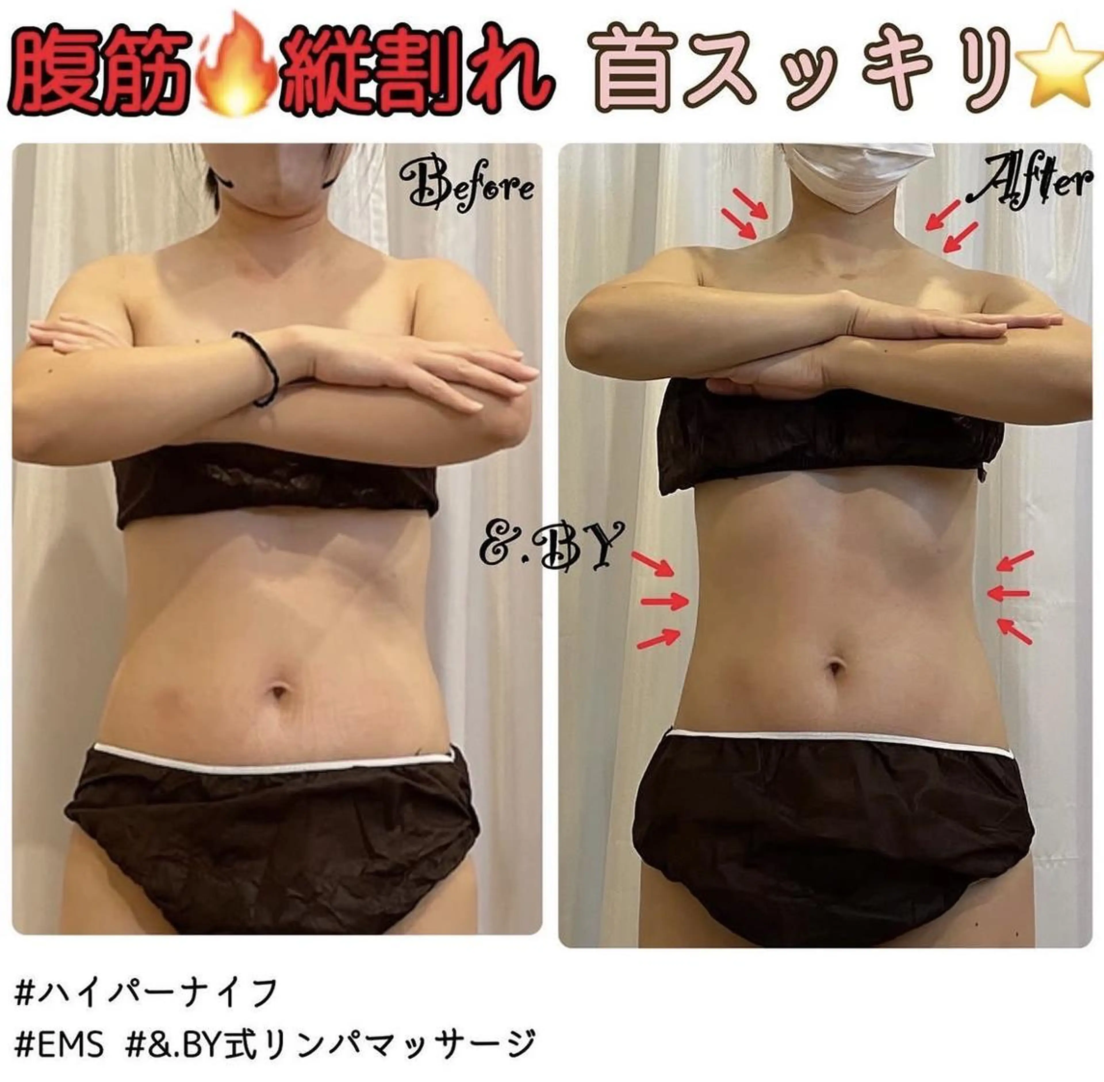 12月限定【美シルエット強化】なかなか痩せない二の腕/背中のお肉撃退！60min¥2,200の写真