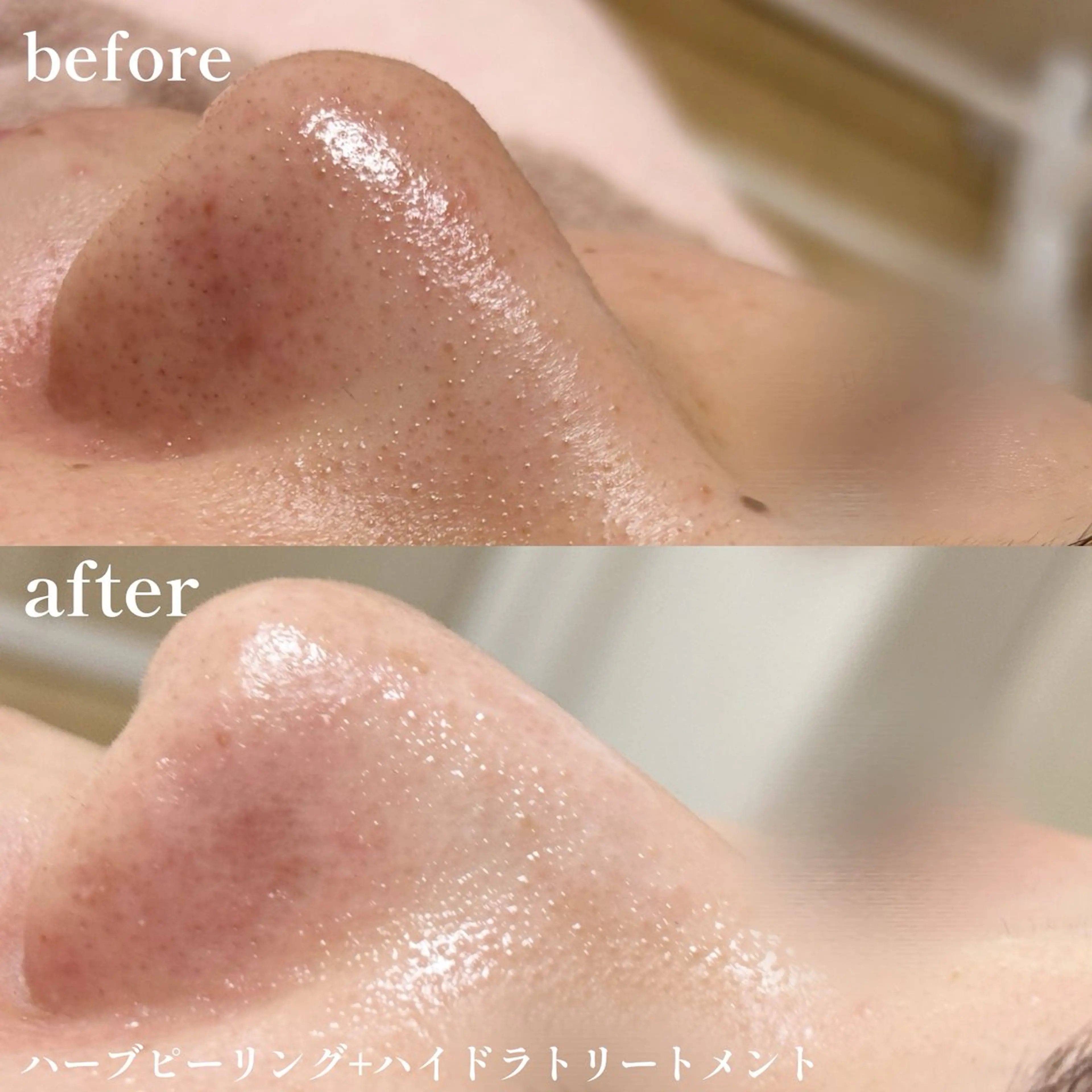 その他 lulularico Yu🫧のエステ・リラクイメージ