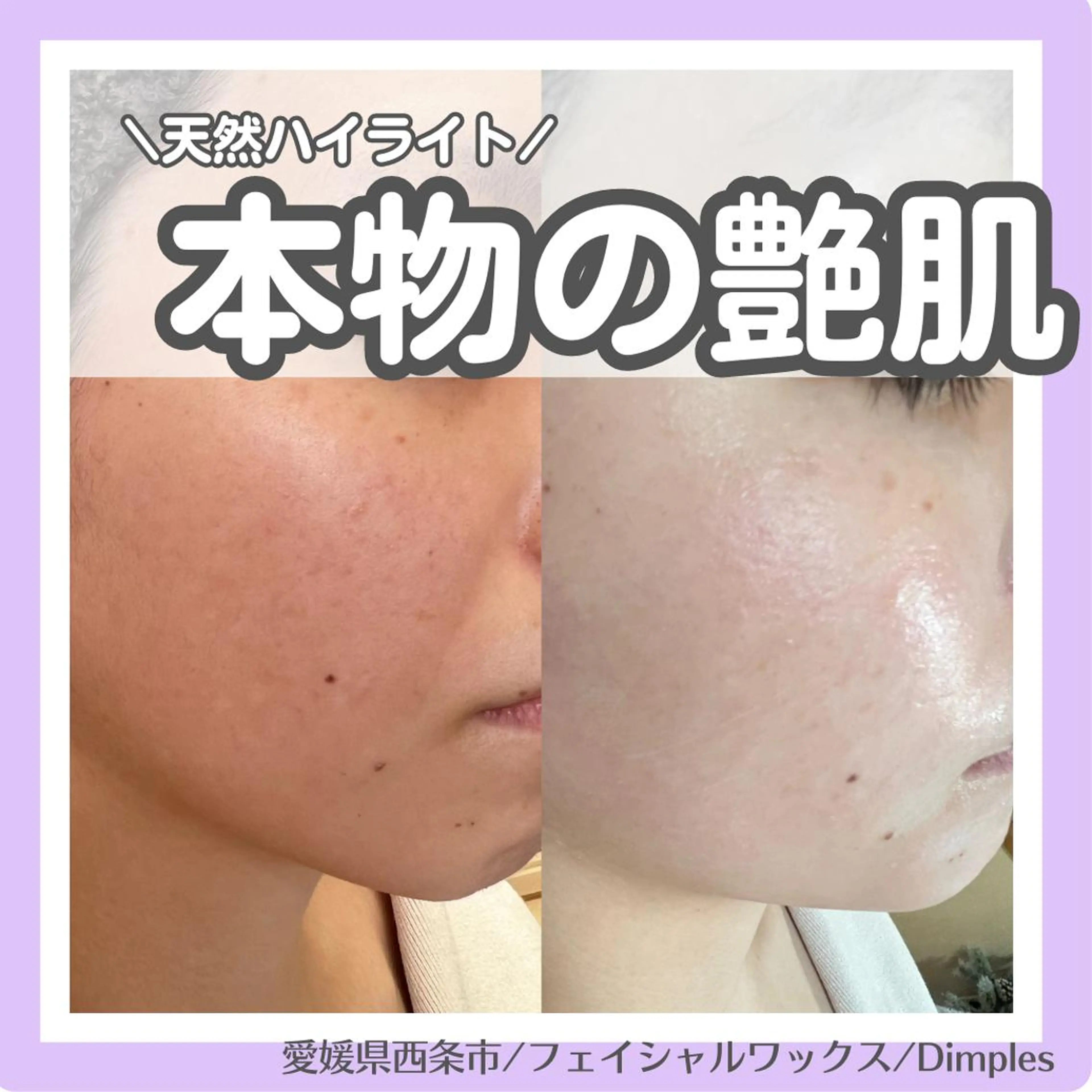 Dimples所属・Dimples ERINAのマツエク・マツパデザイン