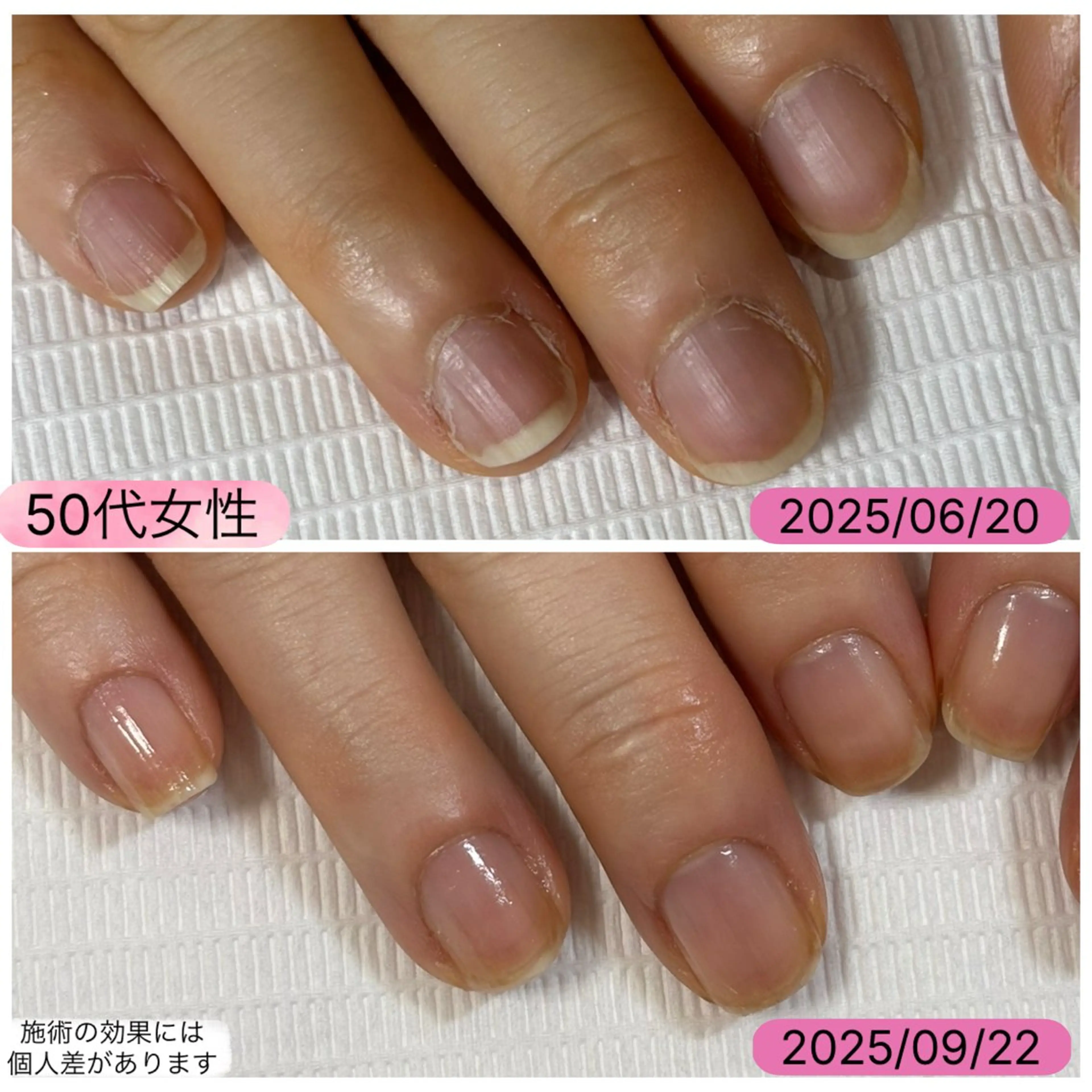 ネイル 自爪育成専門サロン エムロードゥ池下のネイルデザイン