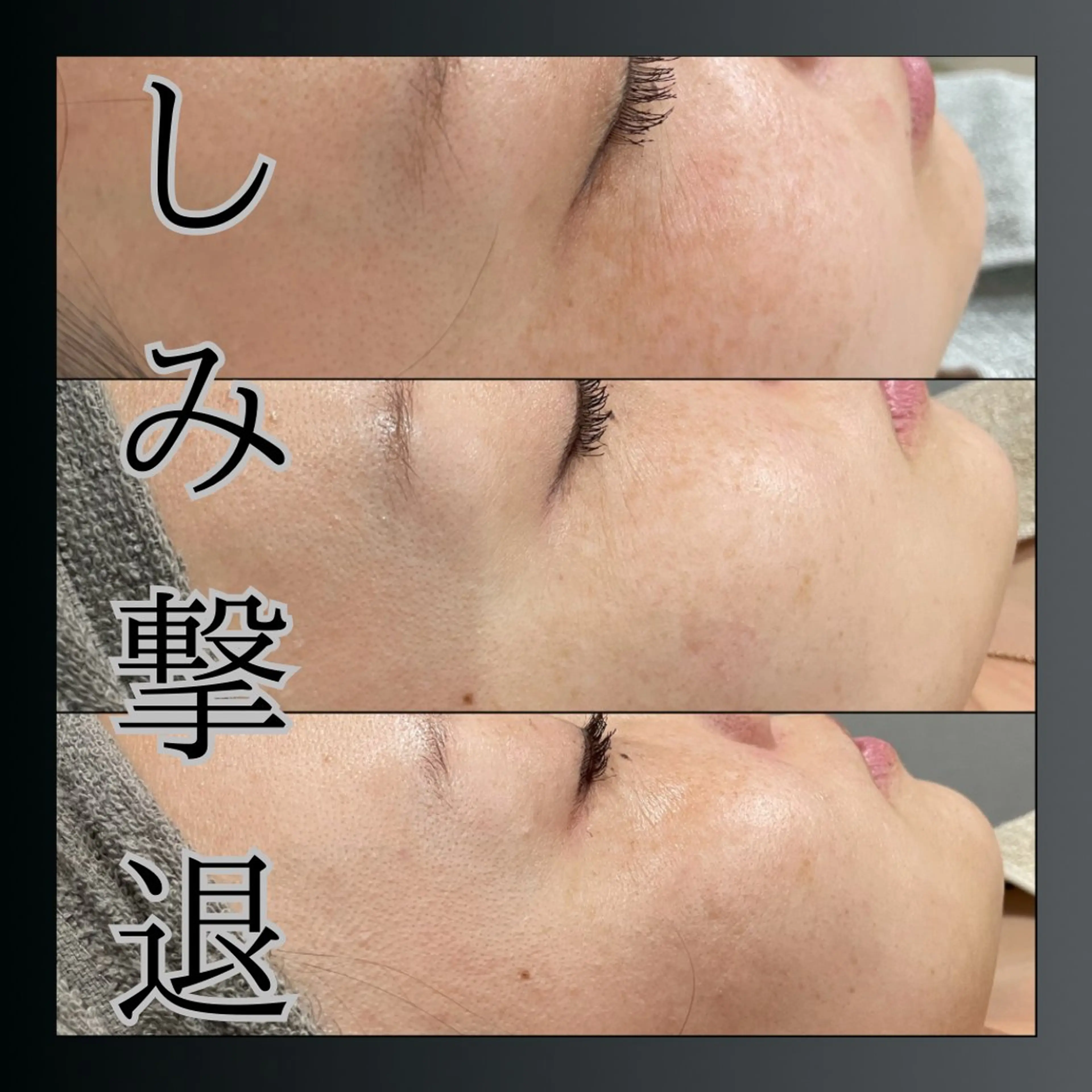 LiZA エステティックサロンのエステ・リラクイメージ