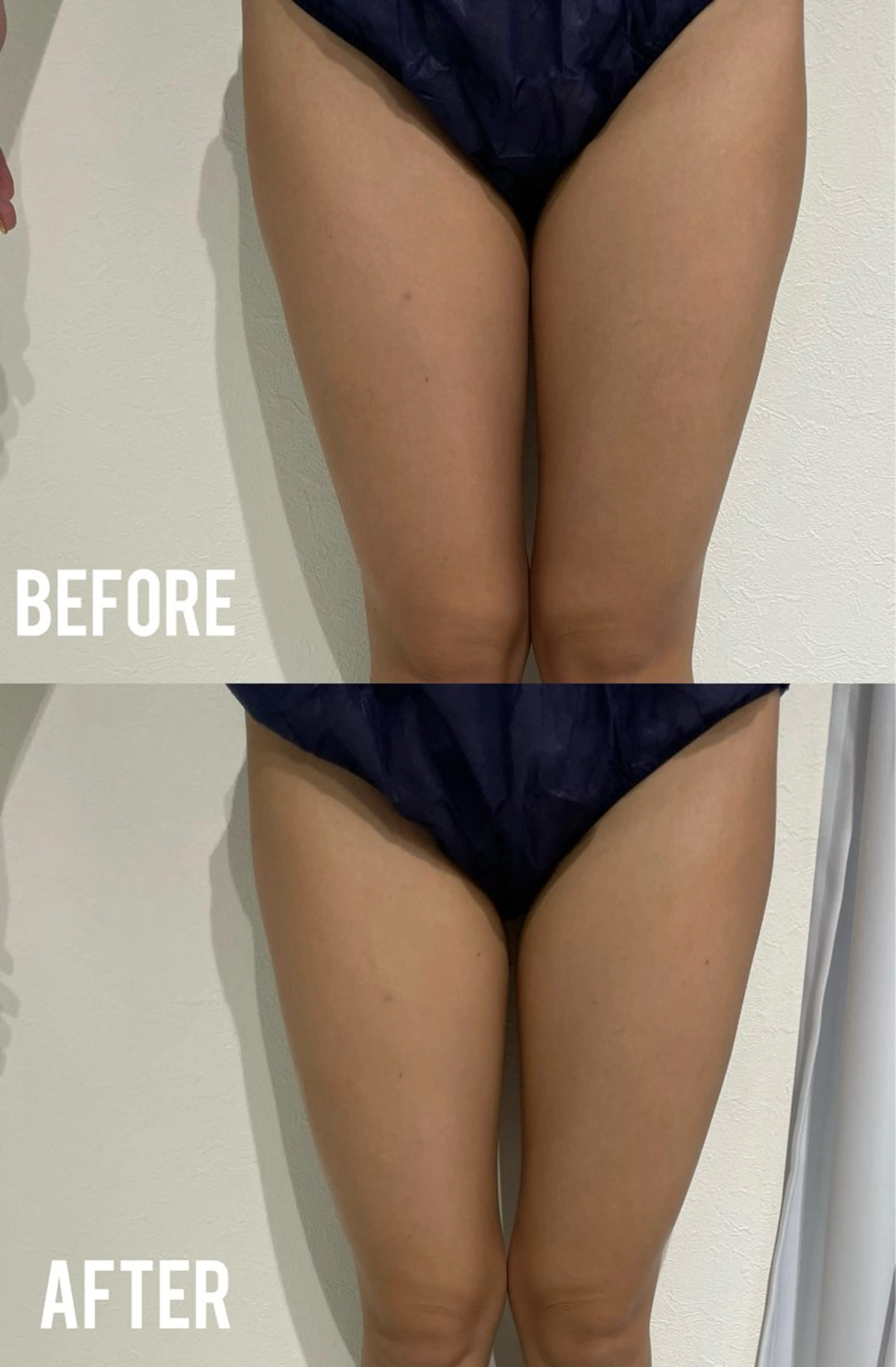 MEITY新宿所属・小顔、毛穴ケア MEITY新宿のエステ・リラクイメージ