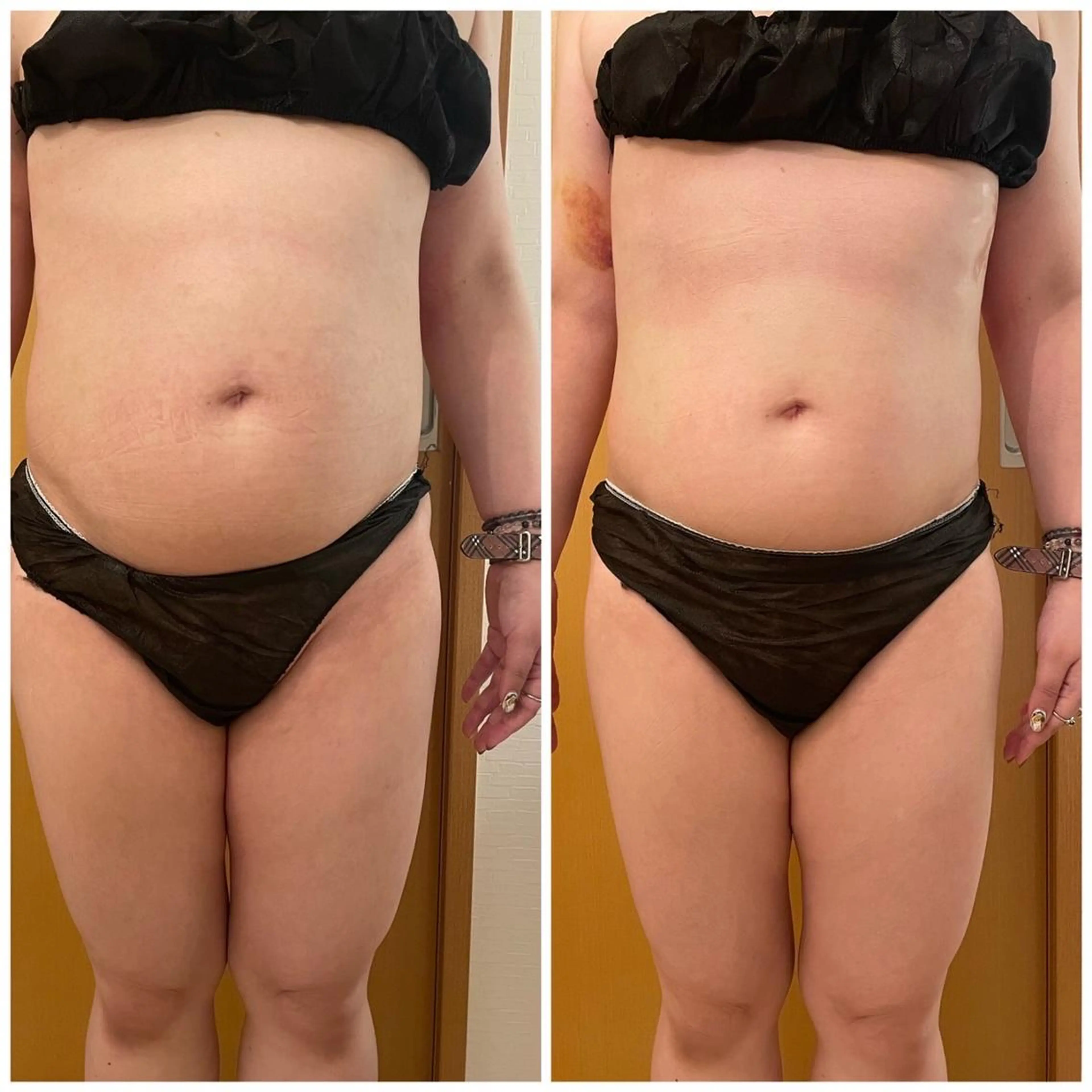 ✨美肌水光✨ アトリエリュバンのエステ・リラクイメージ