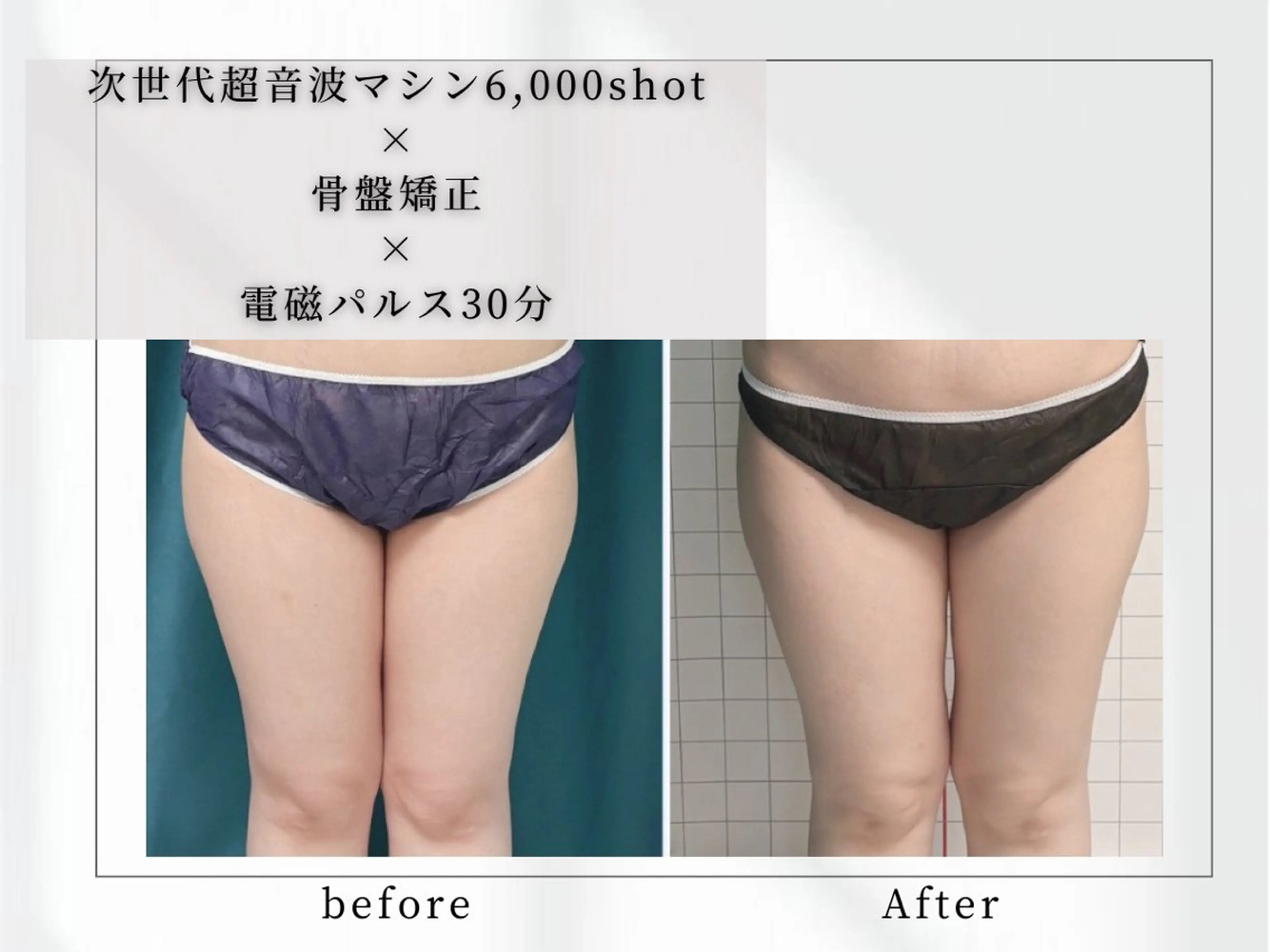 小顔矯正専門店 【RED】池田のエステ・リラクイメージ