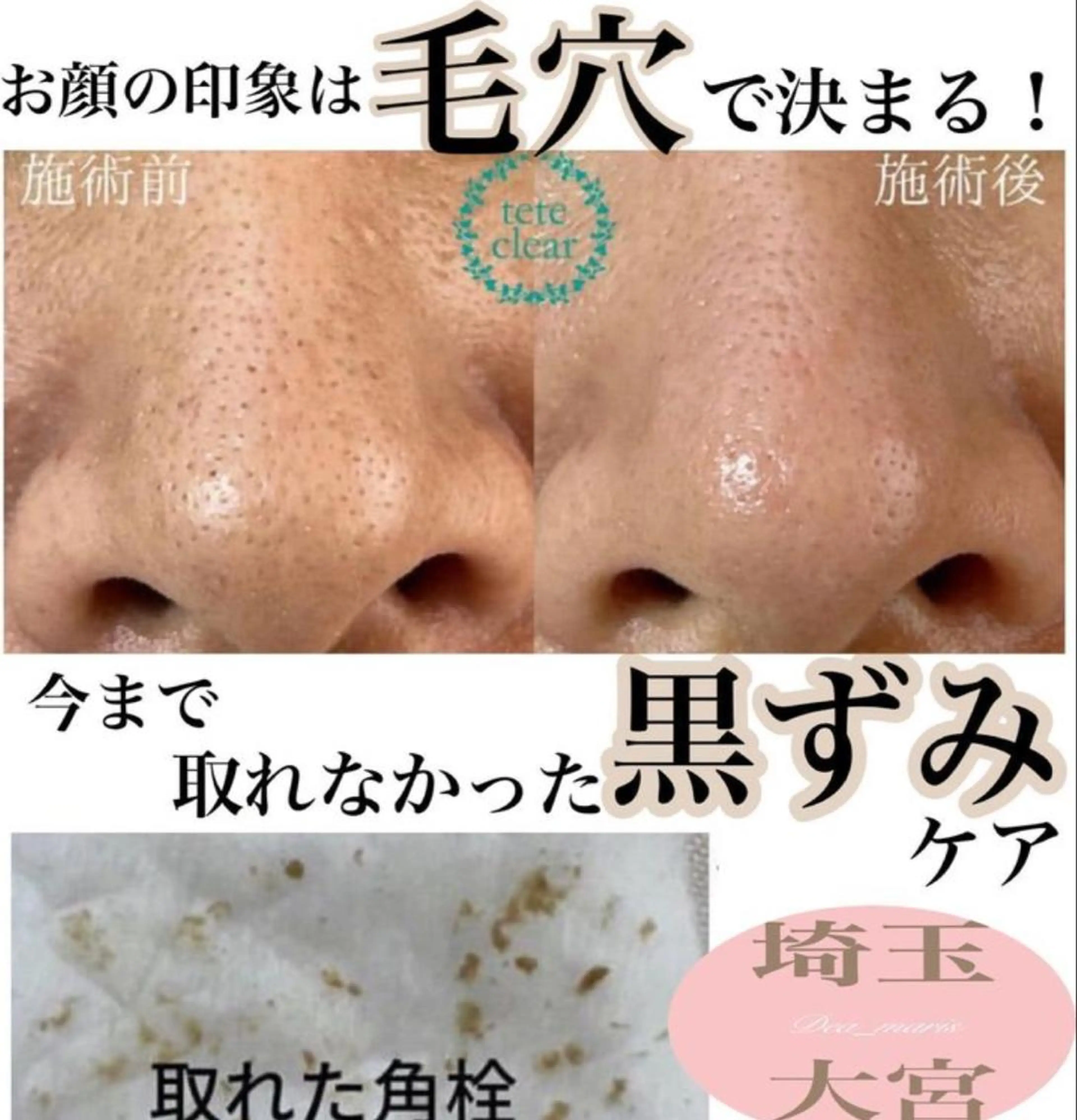 private salon Dea_maris シュガーリング&パーソナルボディケア所属・シミ改善・韓国肌管理 ボディメイク痩身のその他イメージ