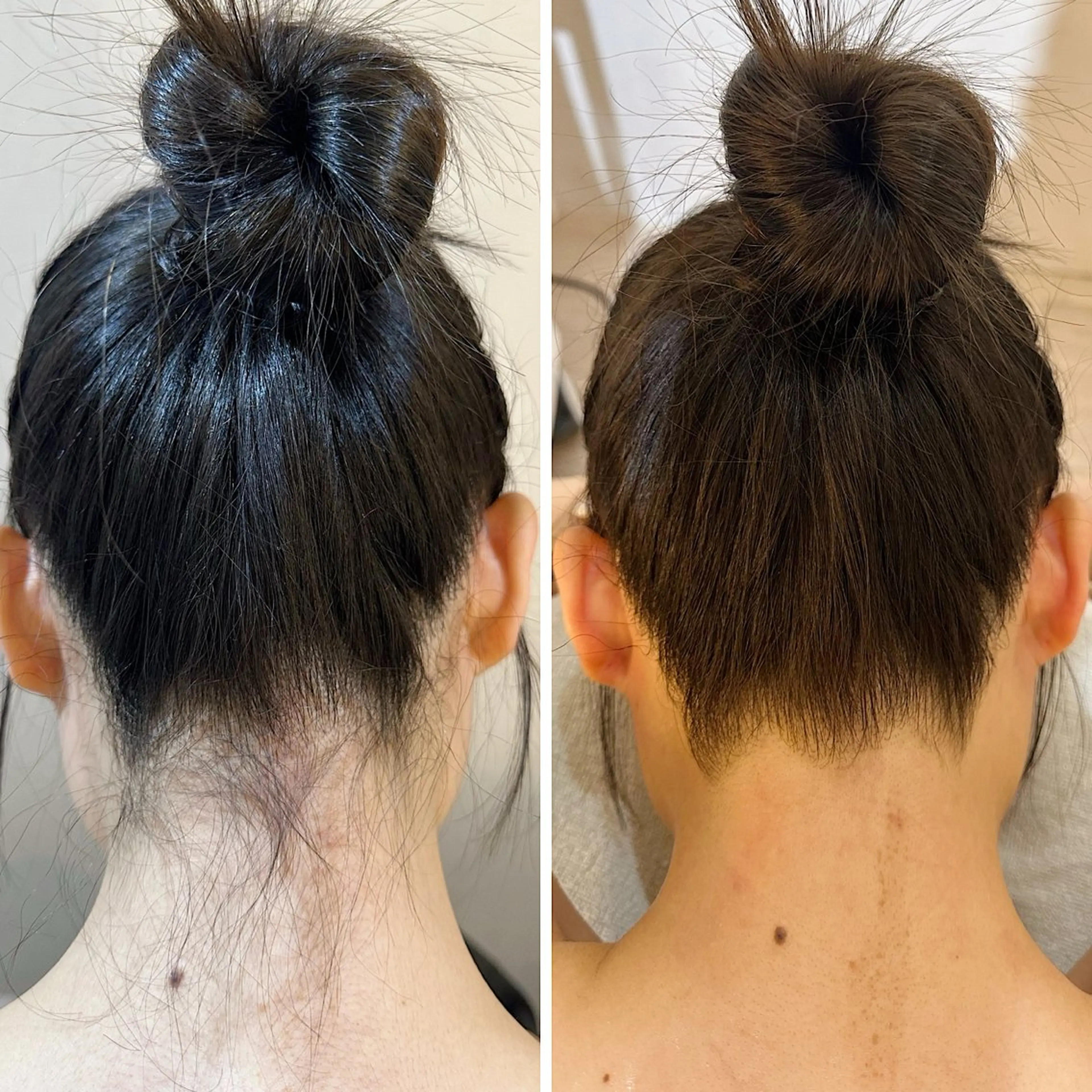 脱毛 うなじ脱毛/美肌脱毛 LABELのエステ・リラクイメージ