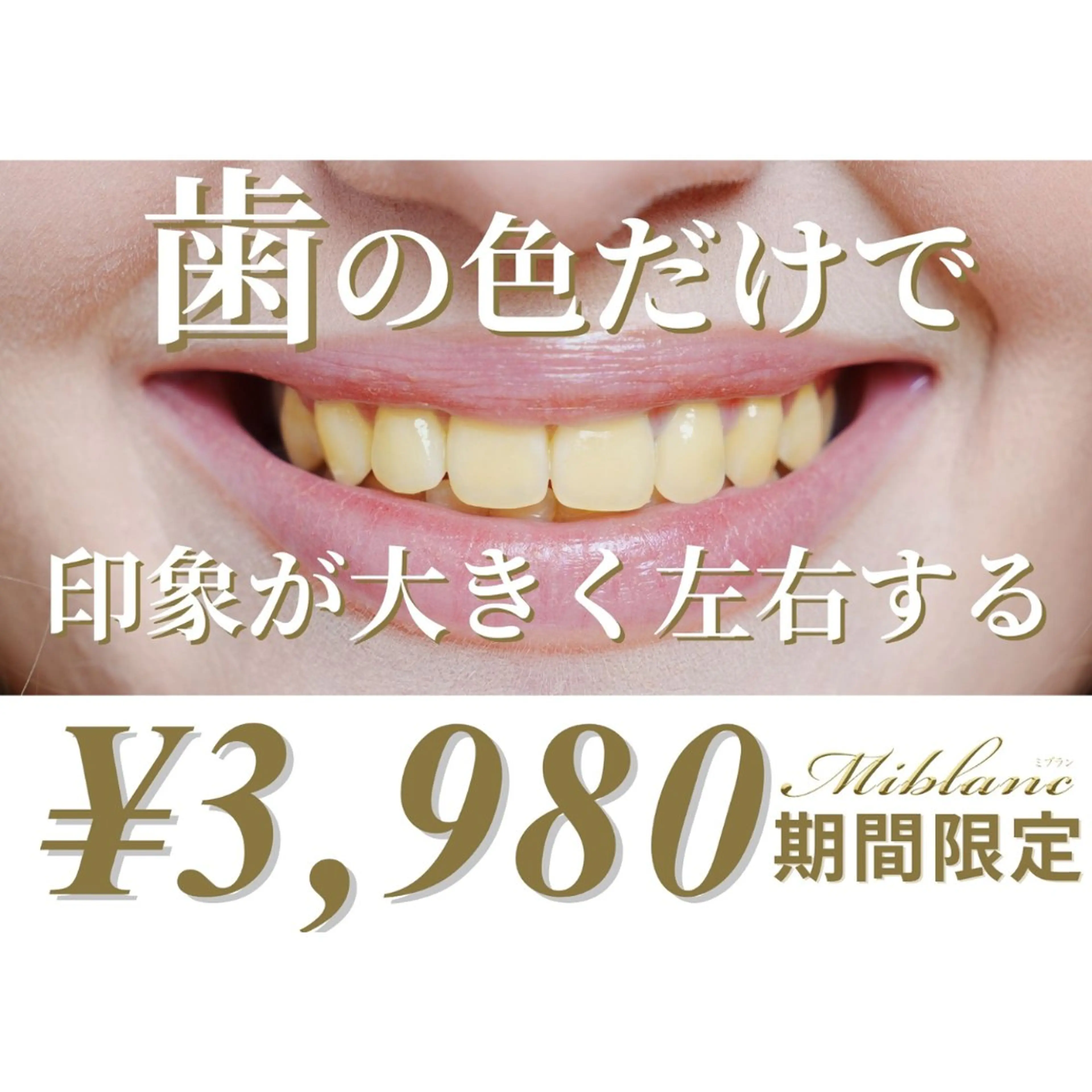 ＼66%off／🍉夏限定割引🎐【白さ効果★★★★★/効果No1】Premiumホワイトニング50分照射の写真