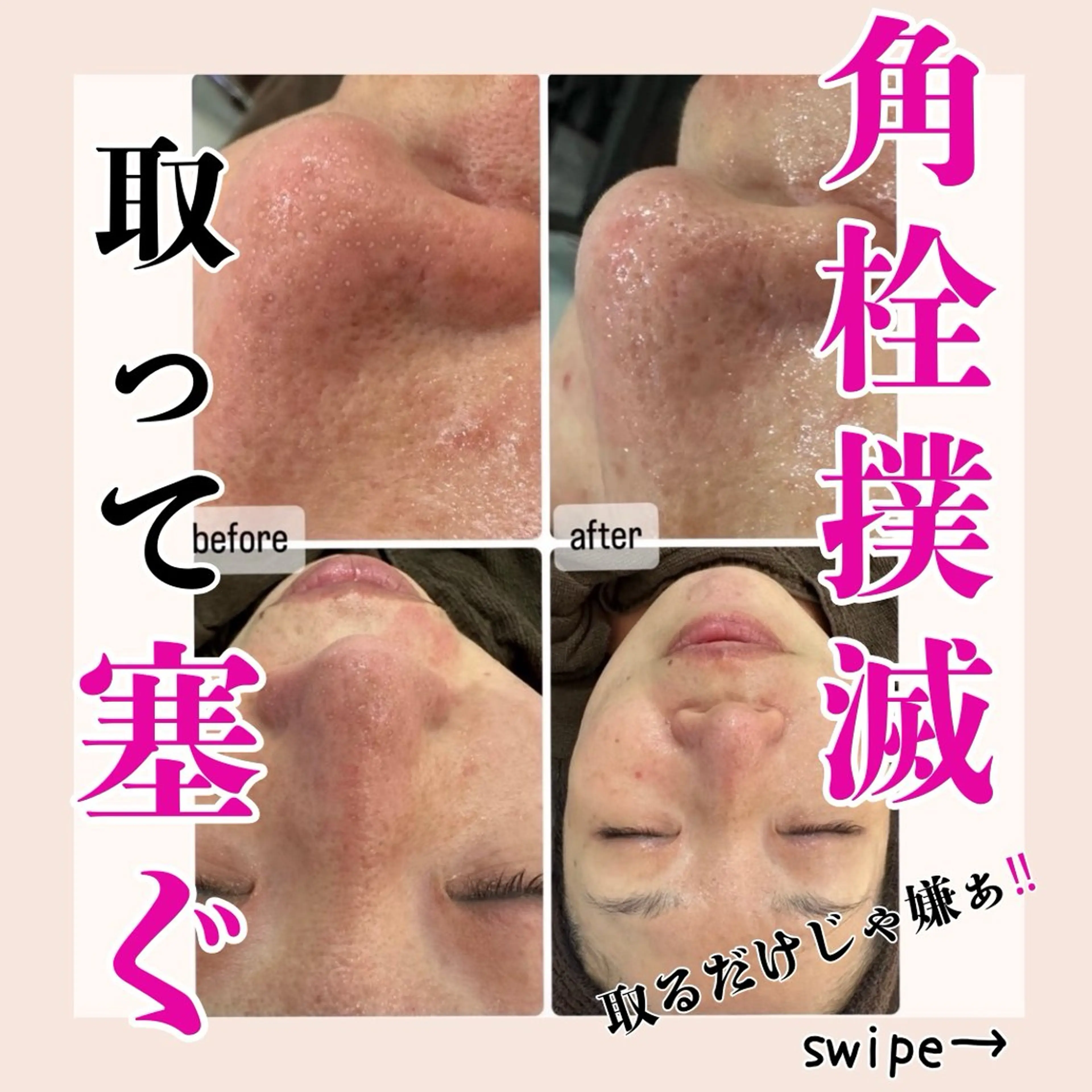毛穴洗浄専門サロン/CareNa梅田【毛穴/ケアナ】所属・CareNa梅田店 🌿住田摩利弥のエステ・リラクイメージ