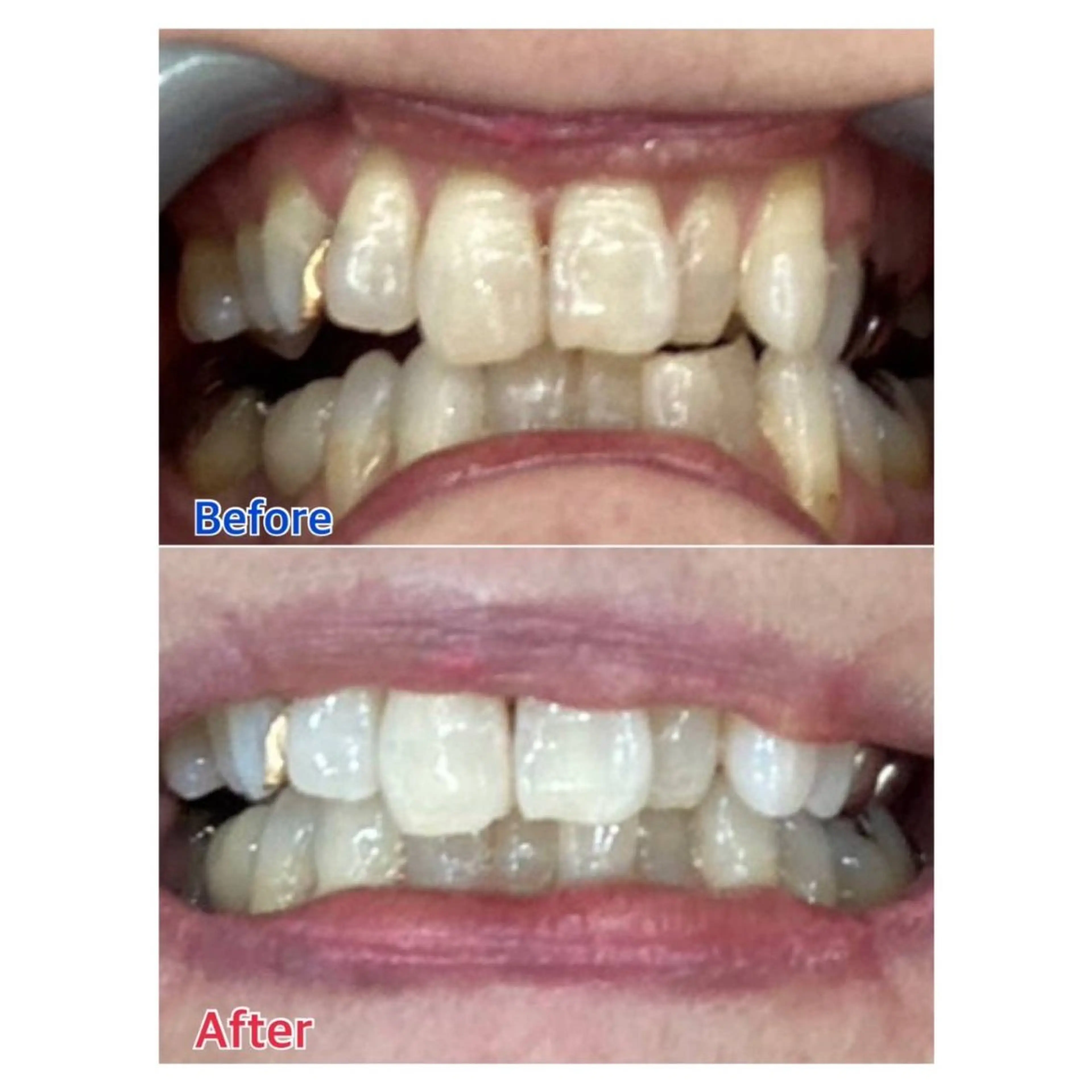 MBEAUTYSALON 千葉店・京成大久保所属・Melty 輝のその他イメージ