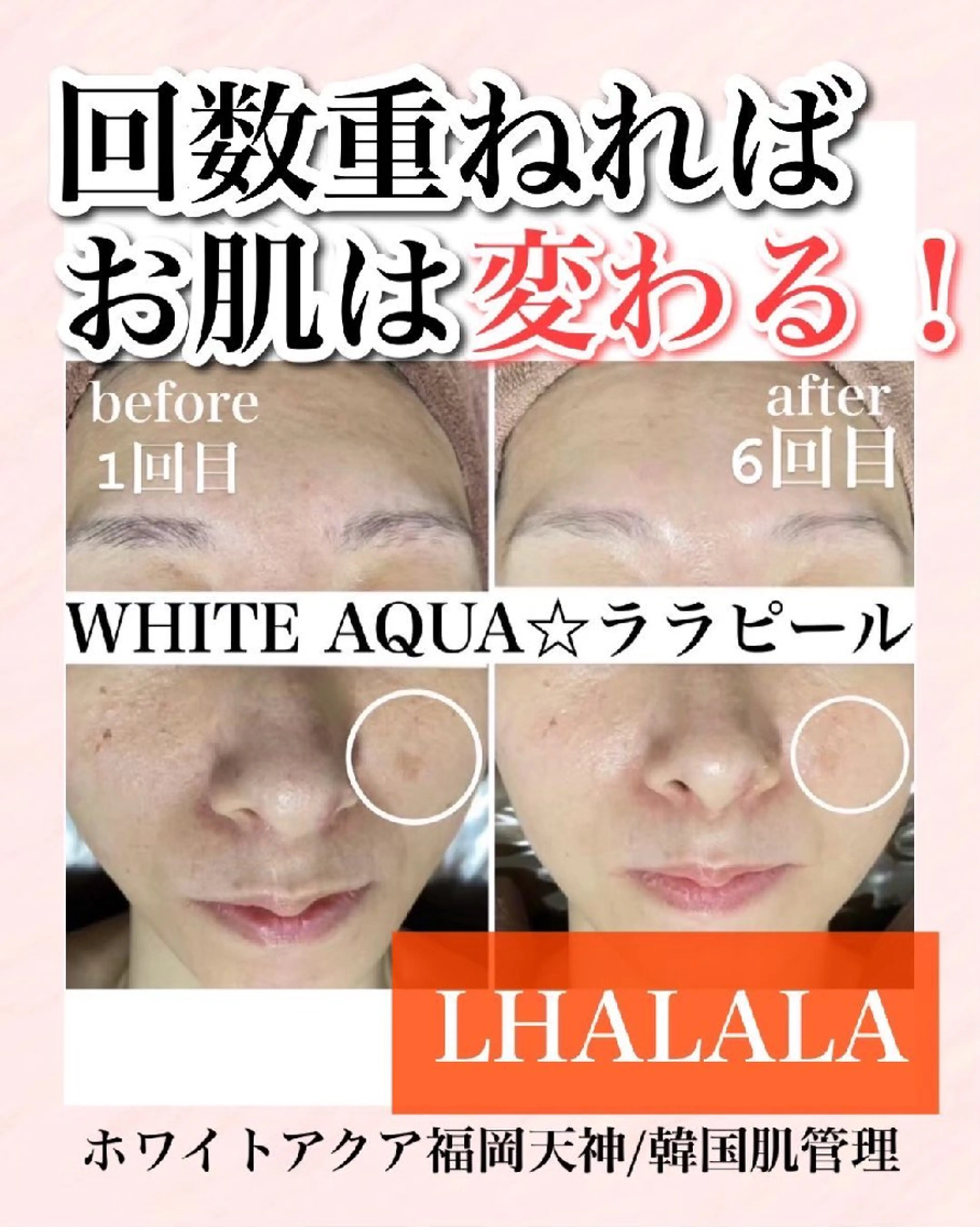 メンズ キッズ WHITEAQUA 福岡天神店のエステ・リラクイメージ