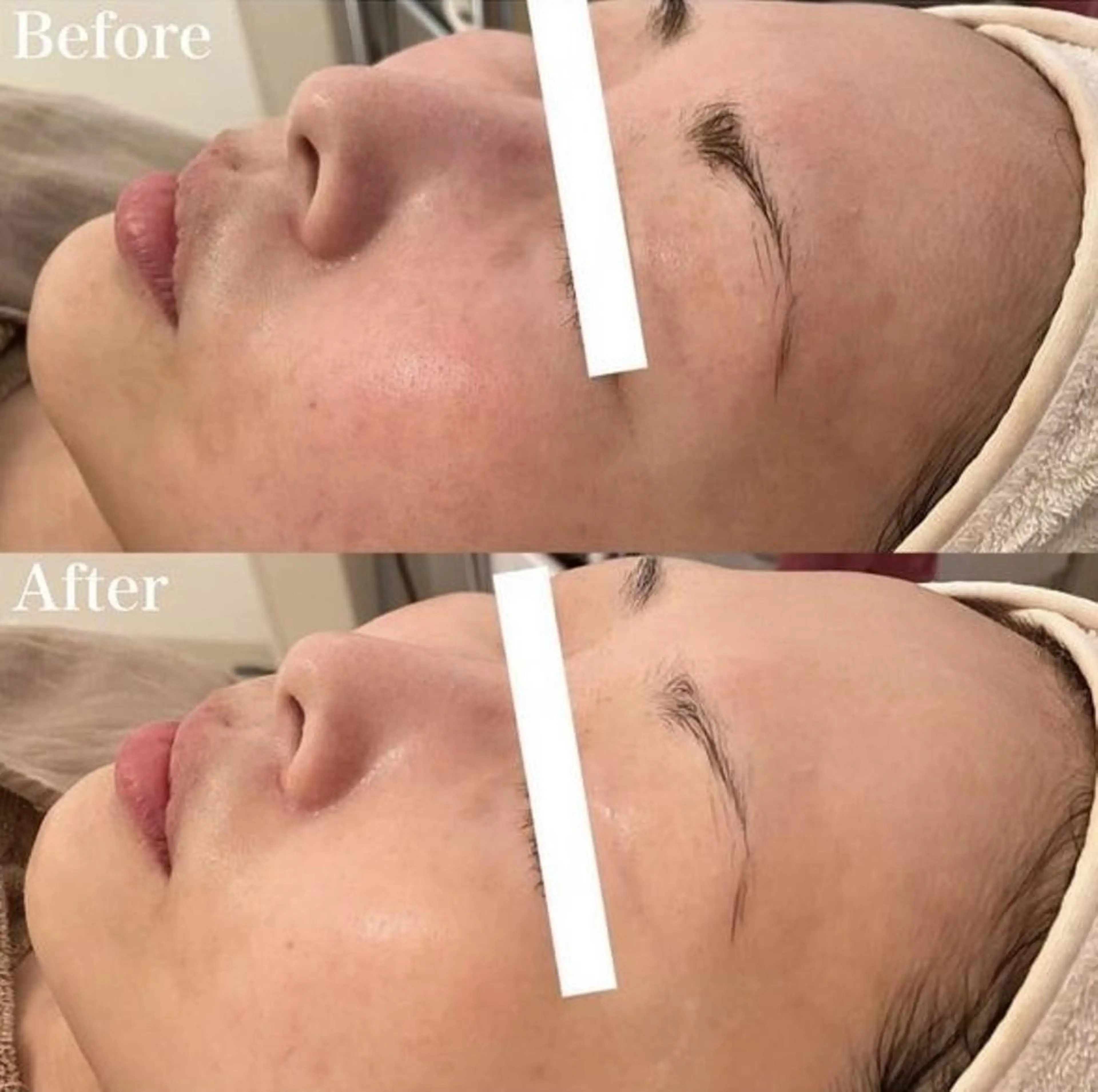 エステ ✨美肌水光✨ アトリエリュバンのエステ・リラクイメージ