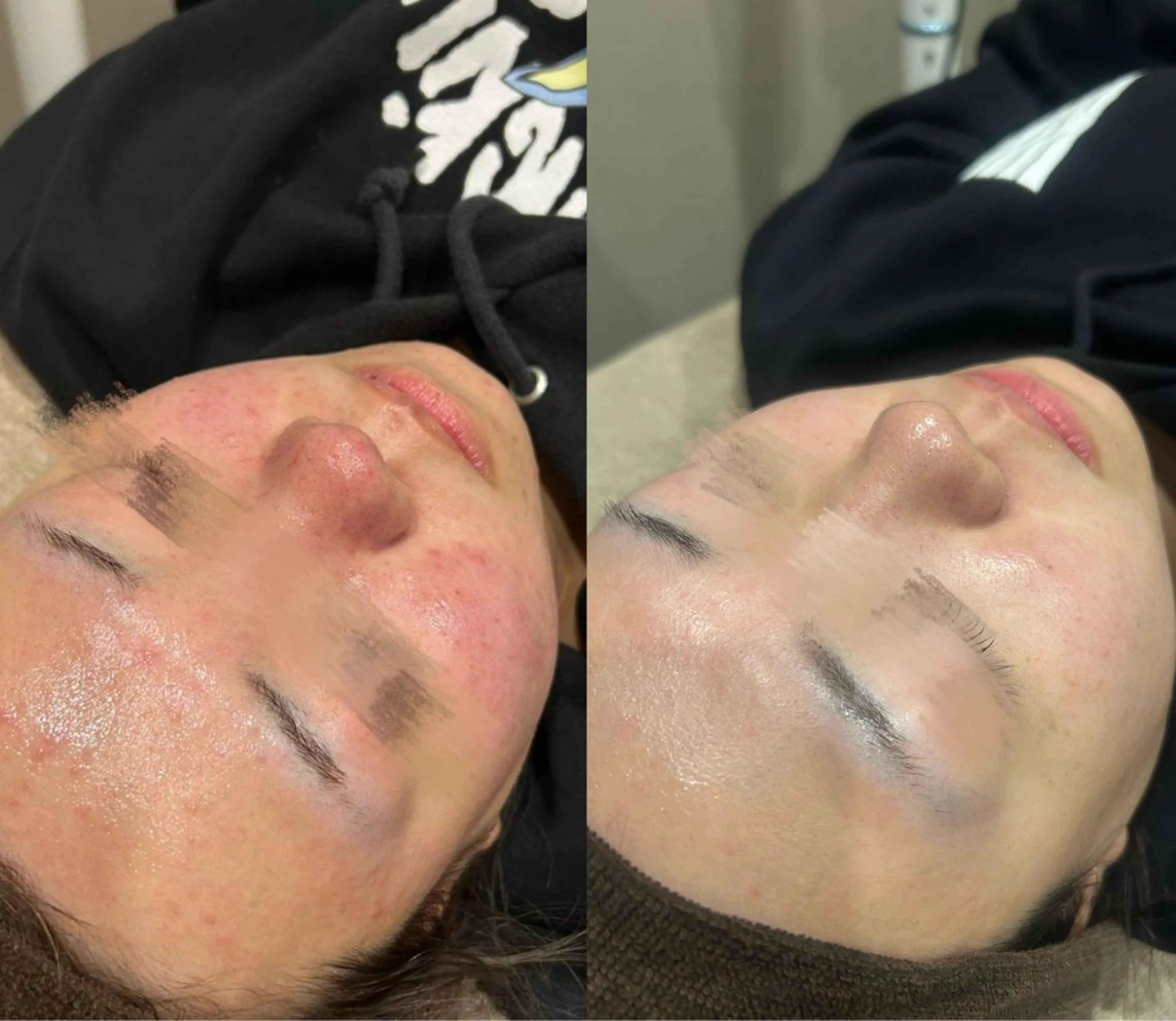 💎美容革命ラボ💎 大名店の眉毛・アイブロウイメージ