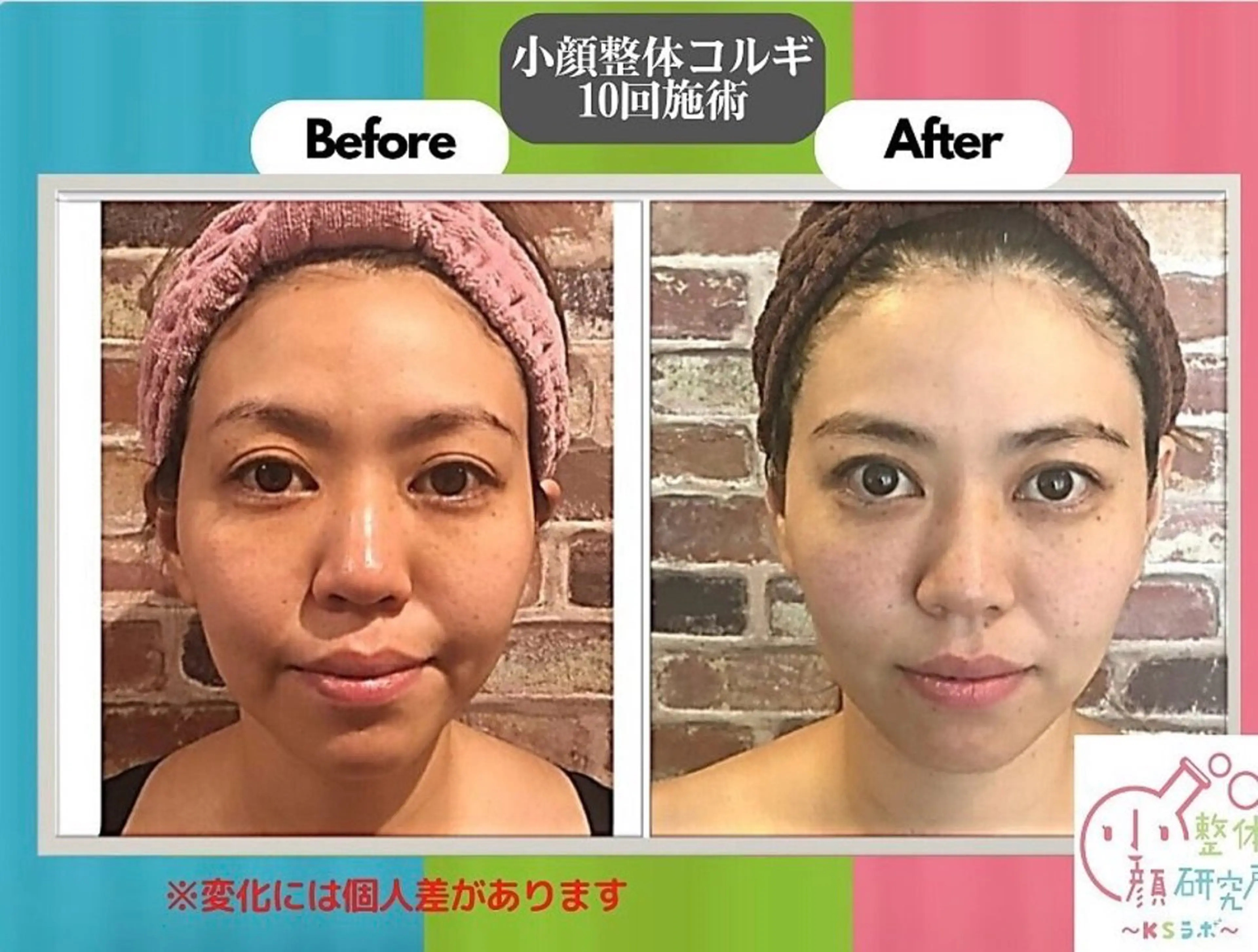 小顔整体コルギ、小顔矯正、リンパマッサージの研修練習台になってくれる方募集！※募集時間詳細に！の写真