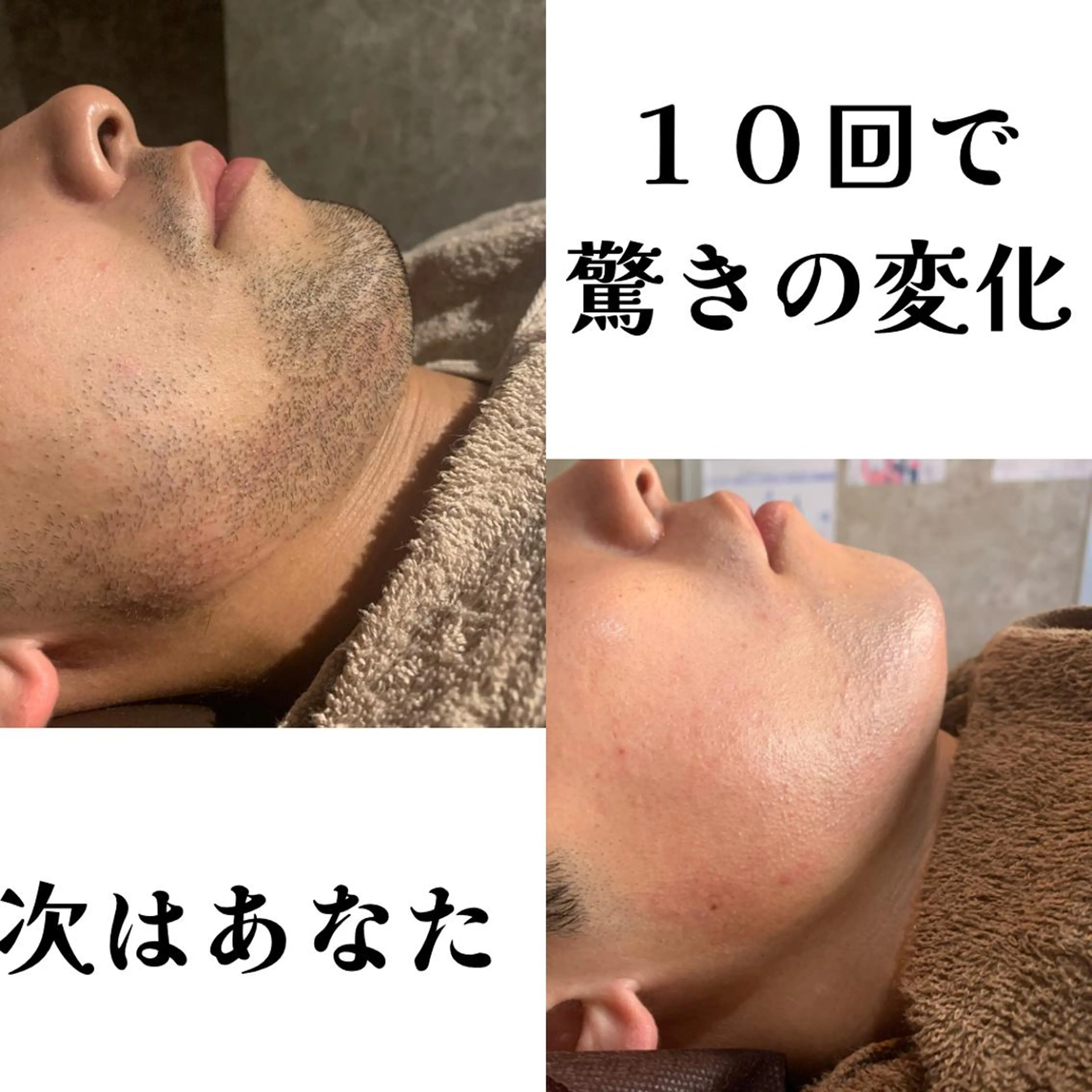 メンズ 20代から始める脱毛 salonLEPIAのエステ・リラクイメージ