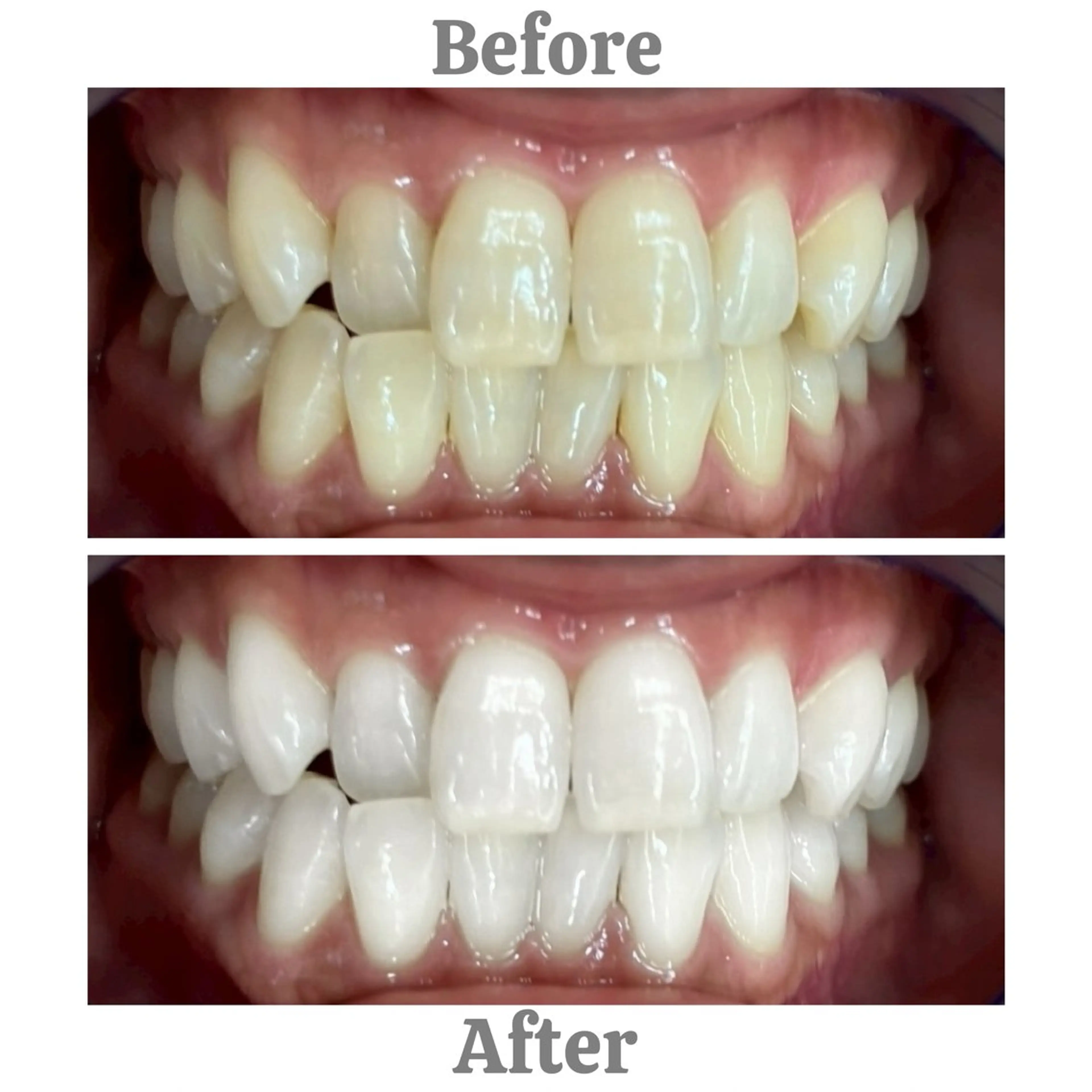 セルフホワイトニング　エクシア相模大野店所属・セルフホワイトニング エクシア相模大野店のその他イメージ