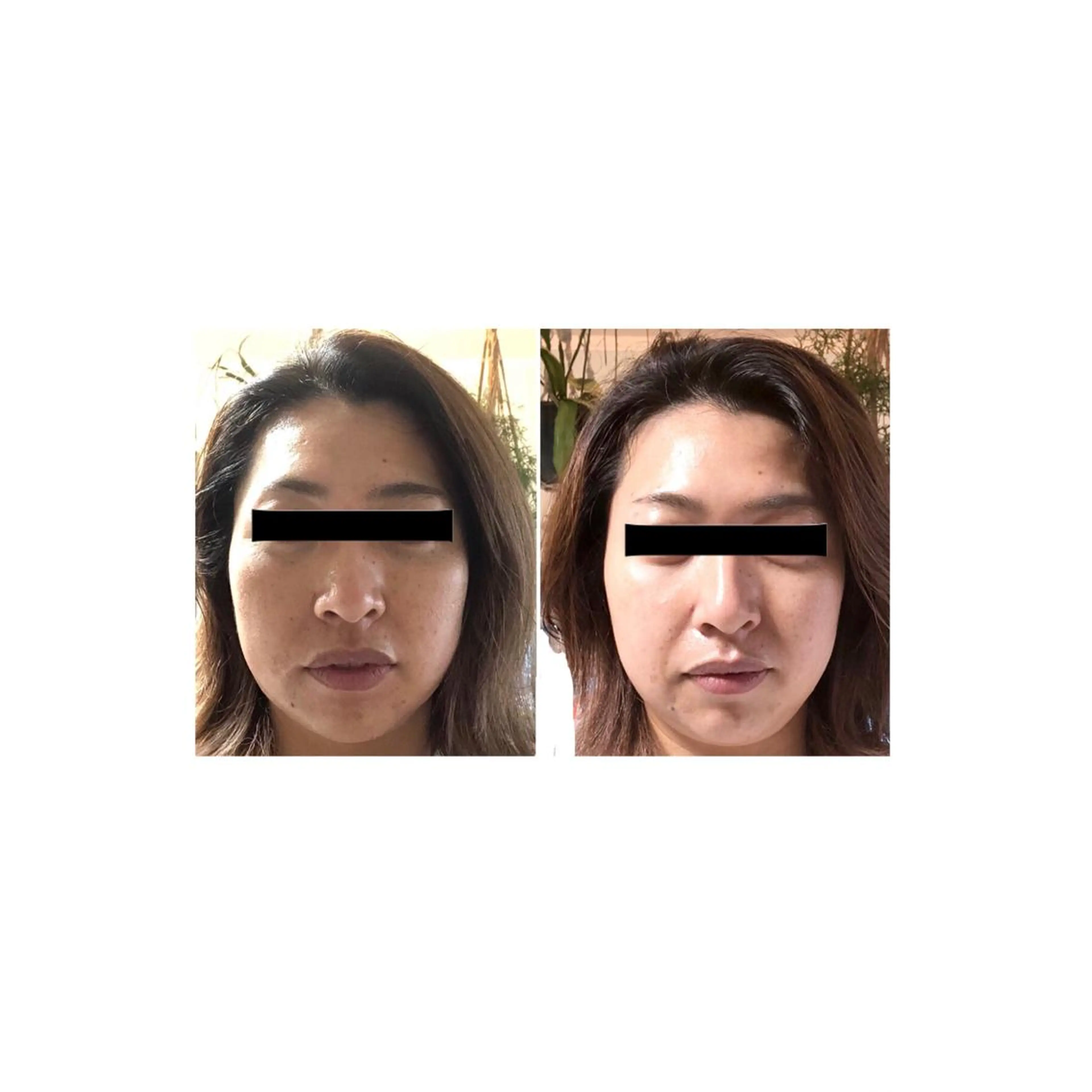 おうちサロン B-ROOMのエステ・リラクイメージ