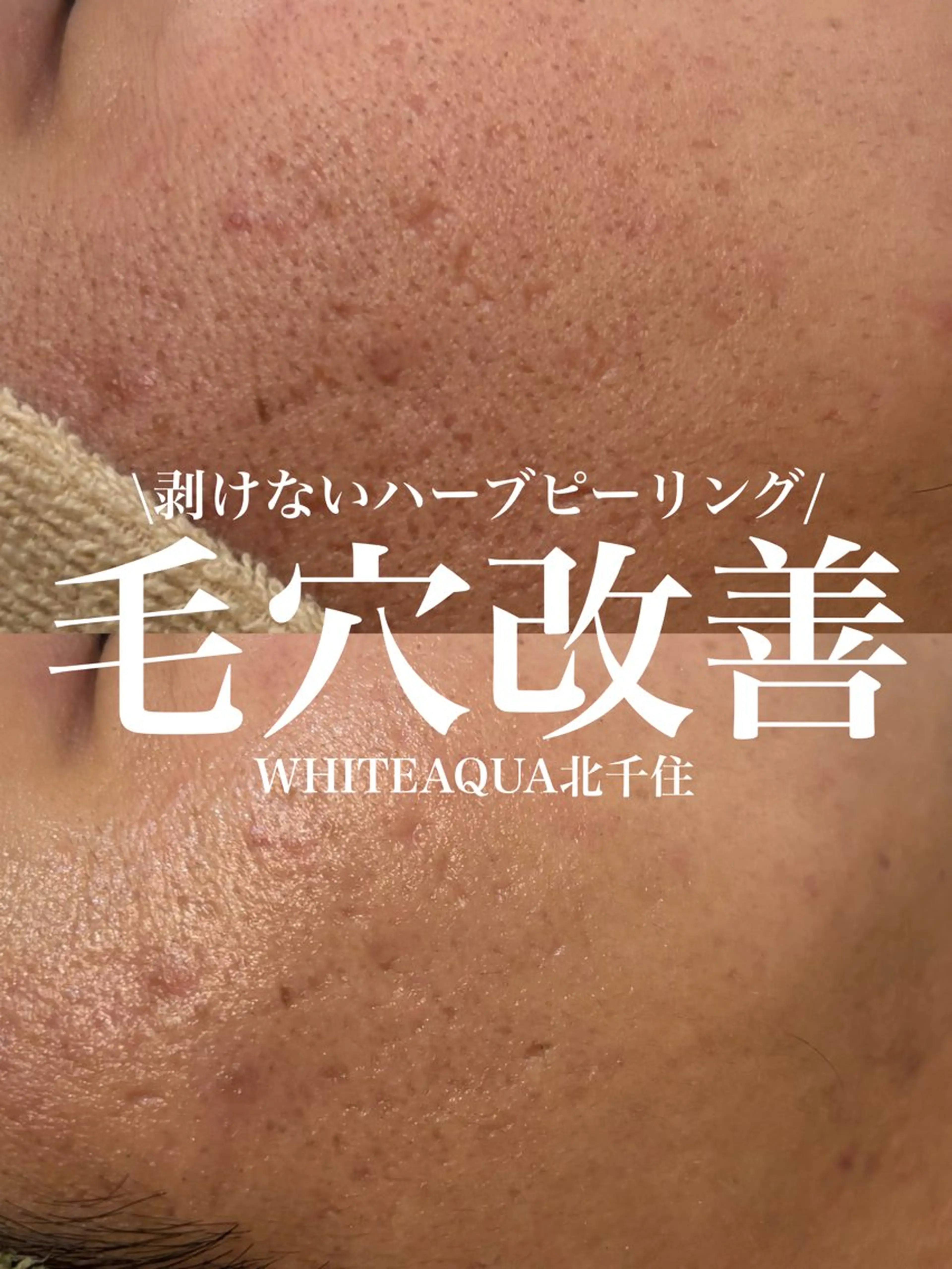 エステ WHITE AQUA 北千住店のエステ・リラクイメージ