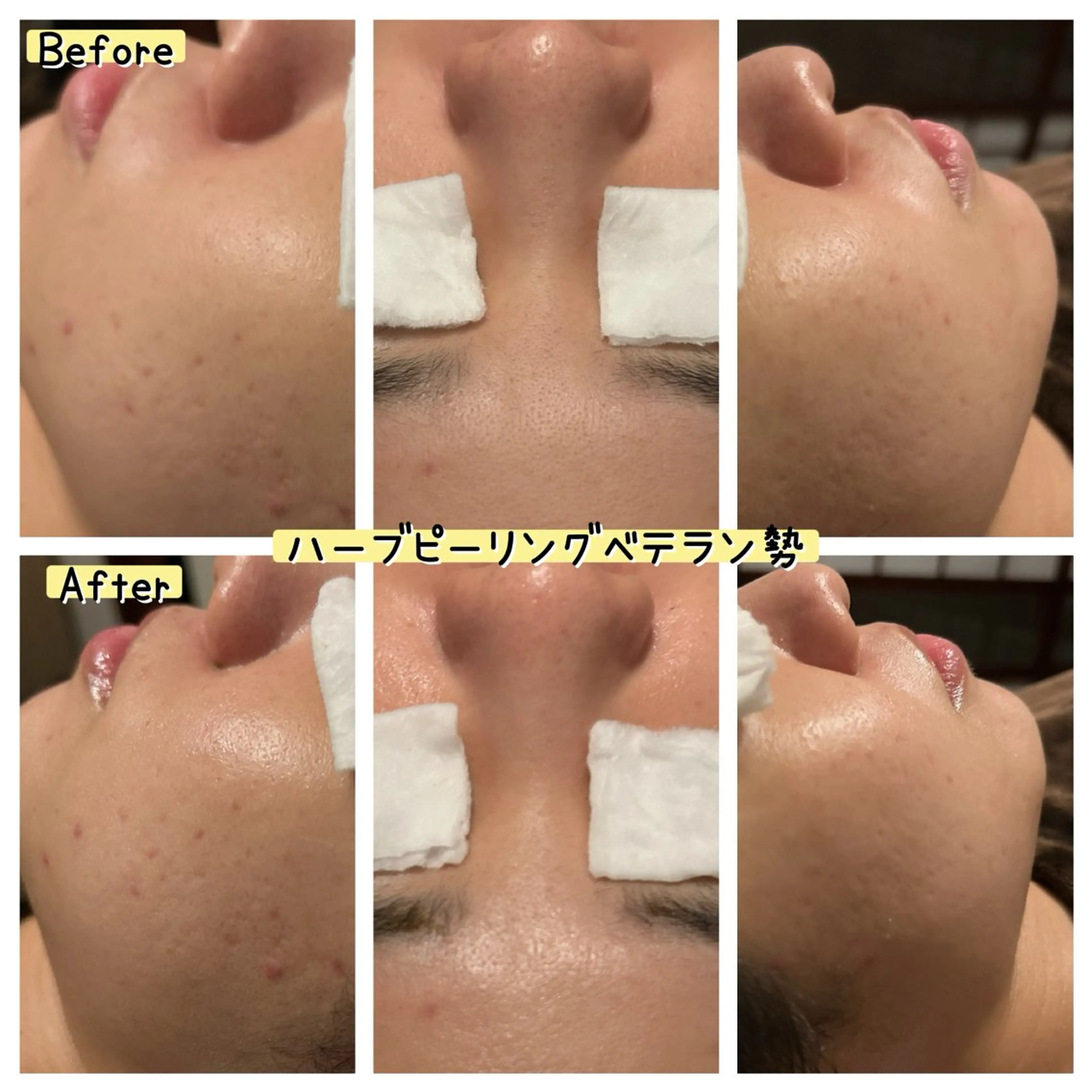 エステ ぱんだ王国エステ所属・ぱんだ王国 エステのエステ・リラクイメージ