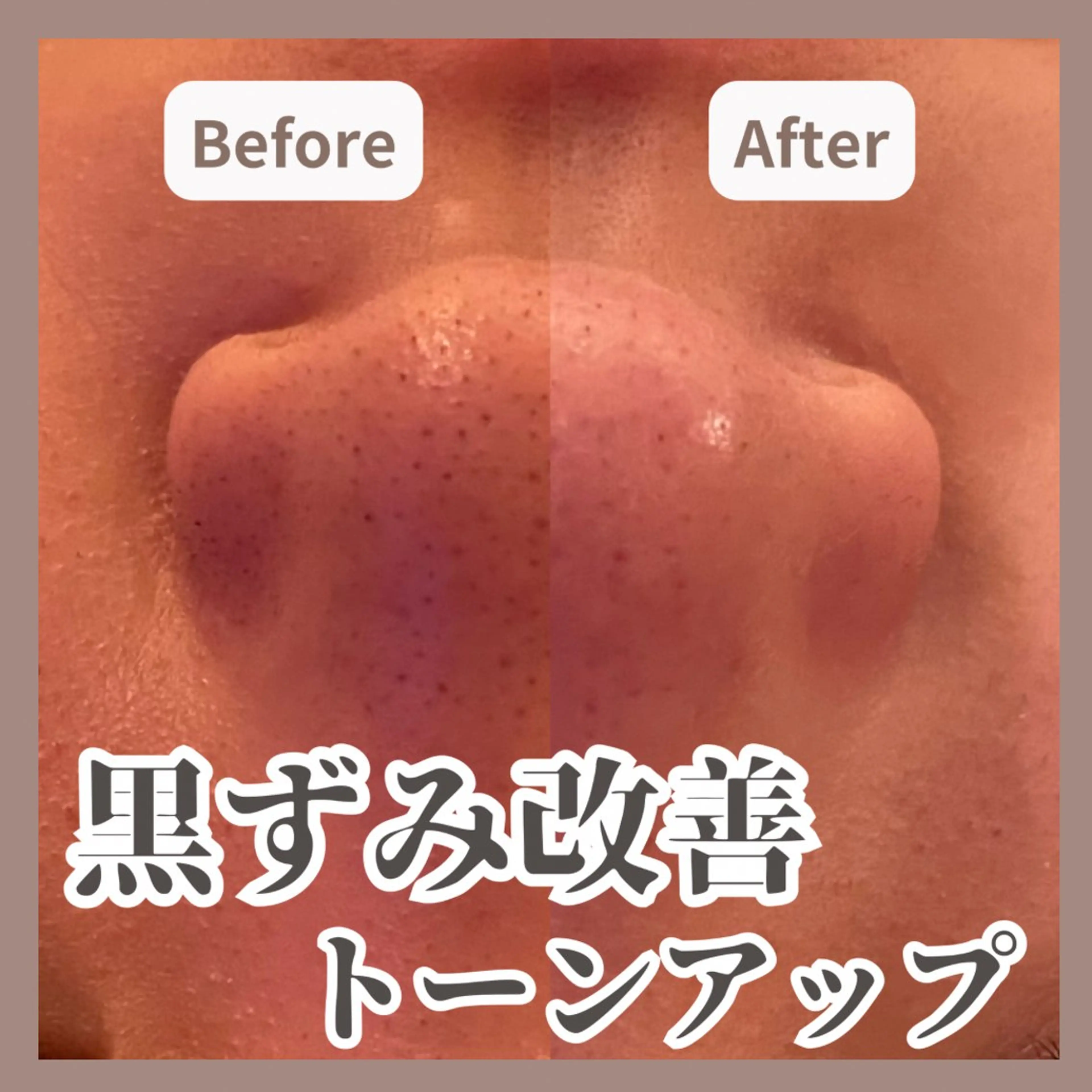 エステ KUGO SALON所属・KUGO SALON _MARINOのその他イメージ