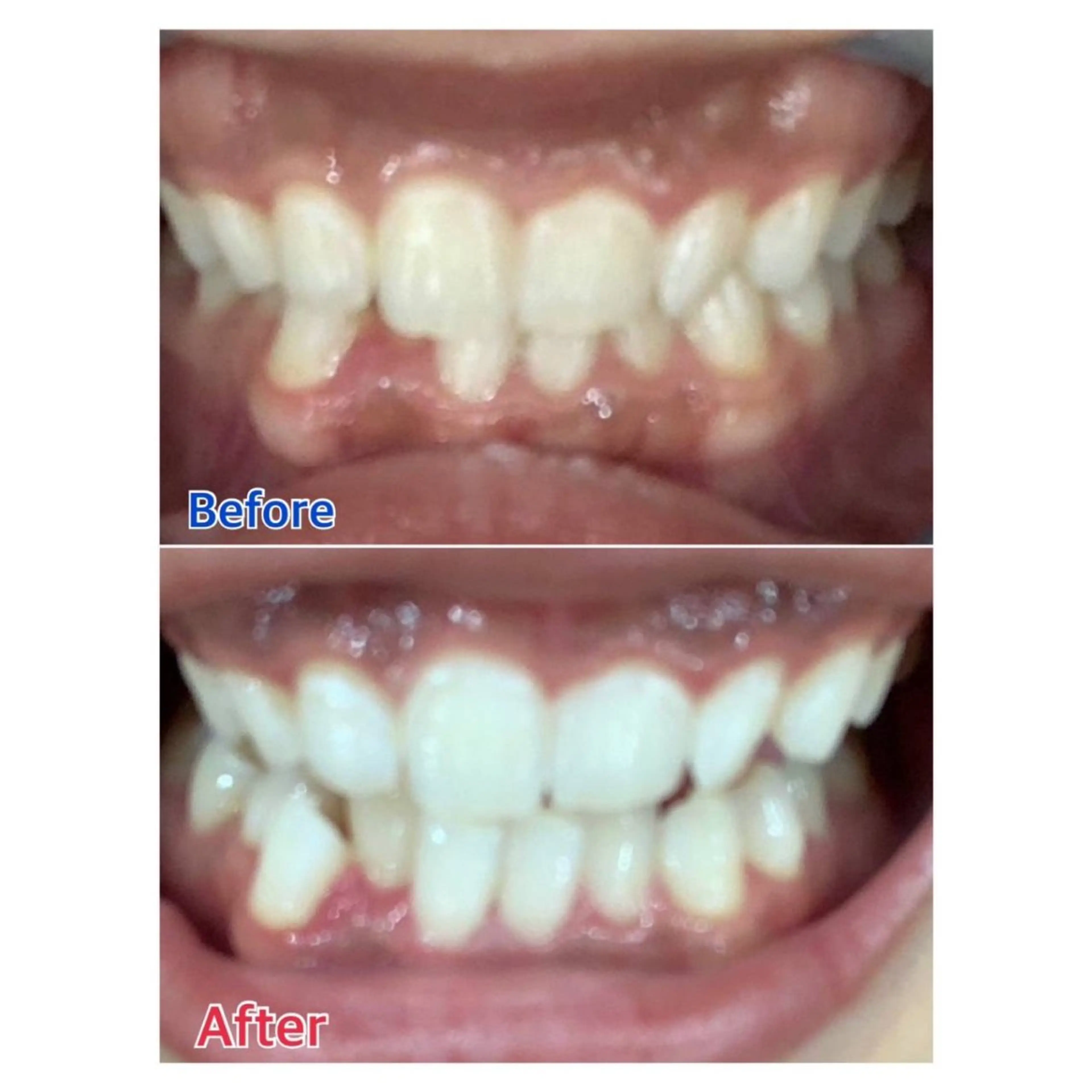 MBEAUTYSALON 千葉店・京成大久保所属・Melty 輝のその他イメージ