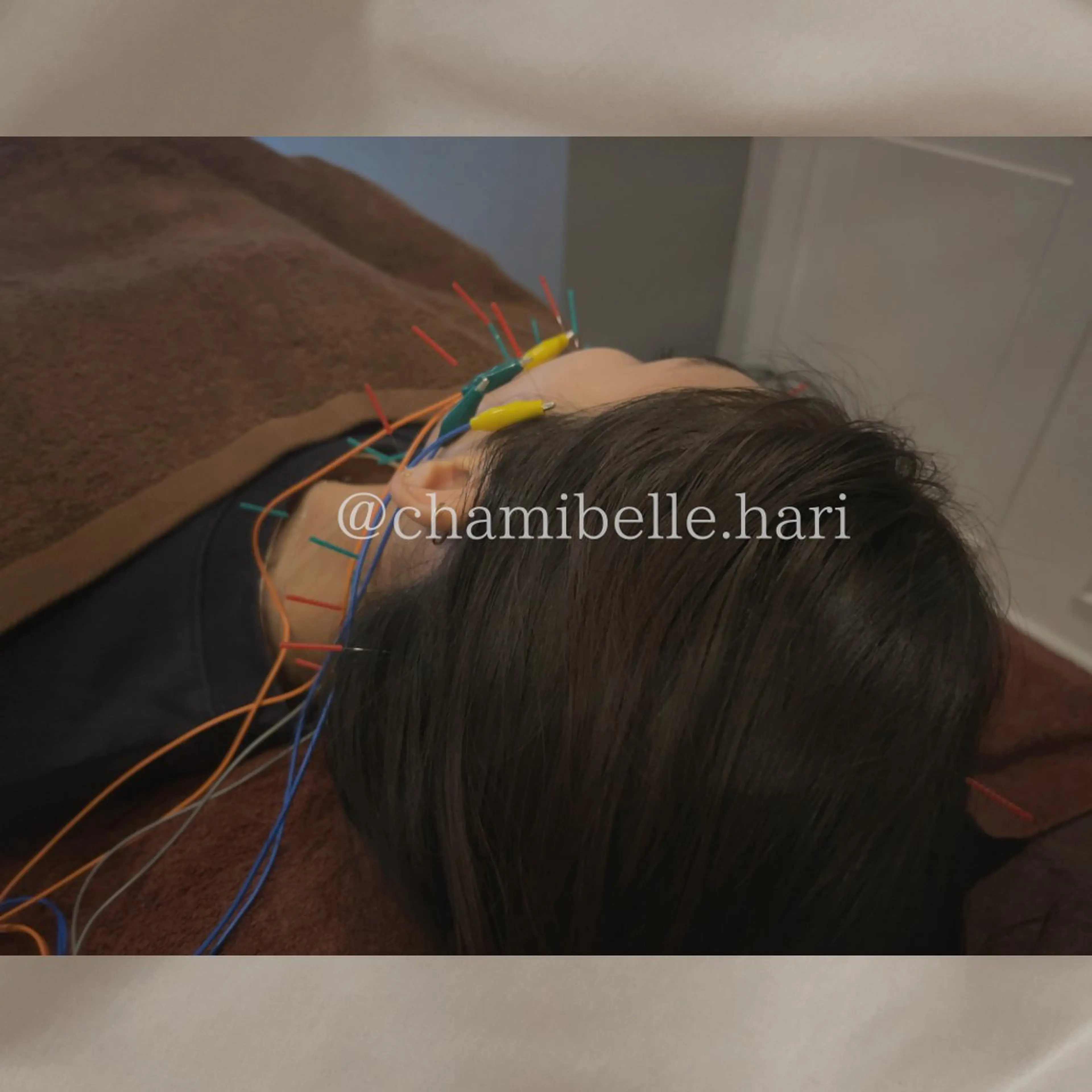 エステ リラク 美容鍼灸サロン Chamibelleのエステ・リラクイメージ