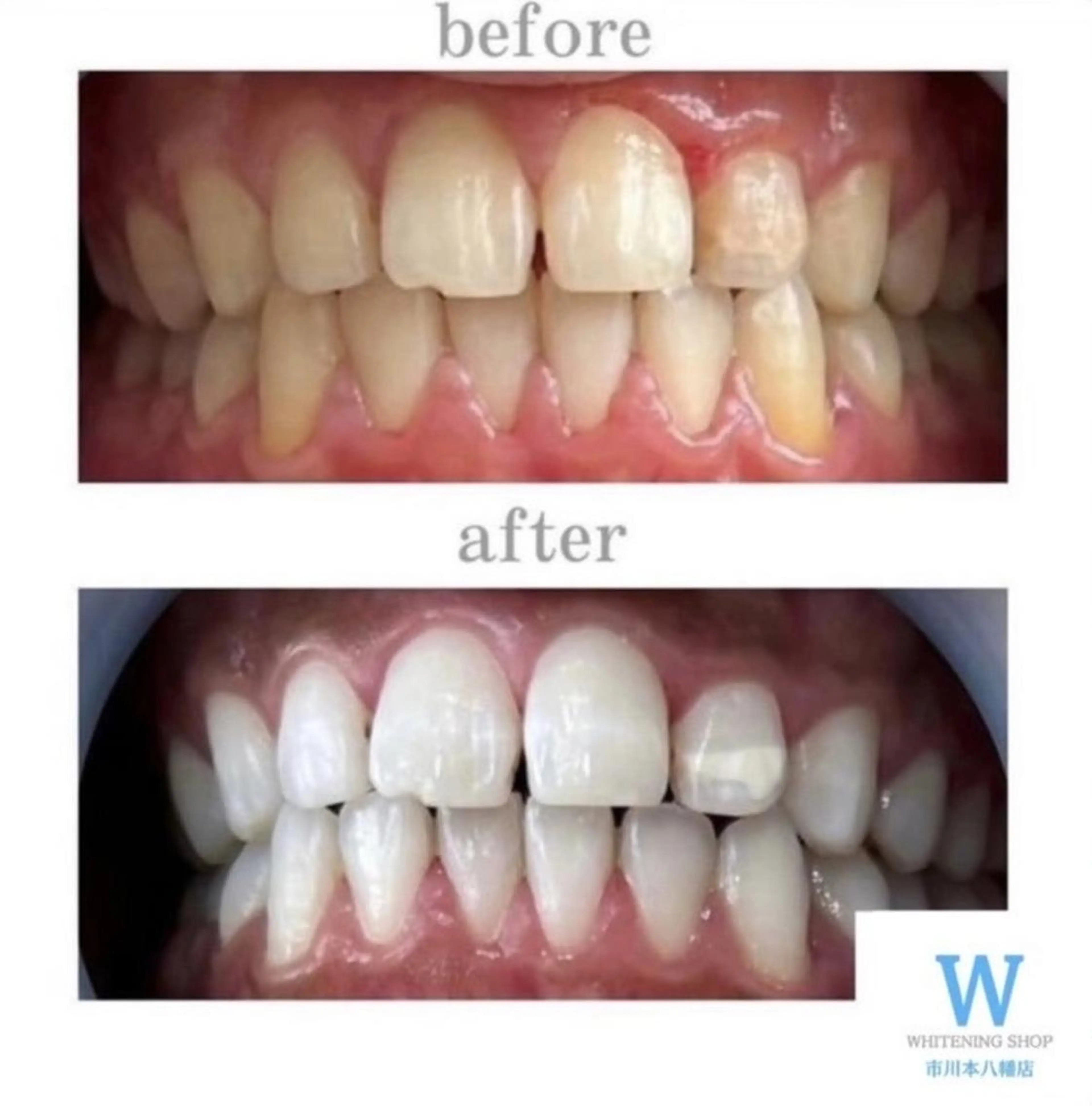 ホワイトニング ショップ本八幡店のエステ・リラクイメージ