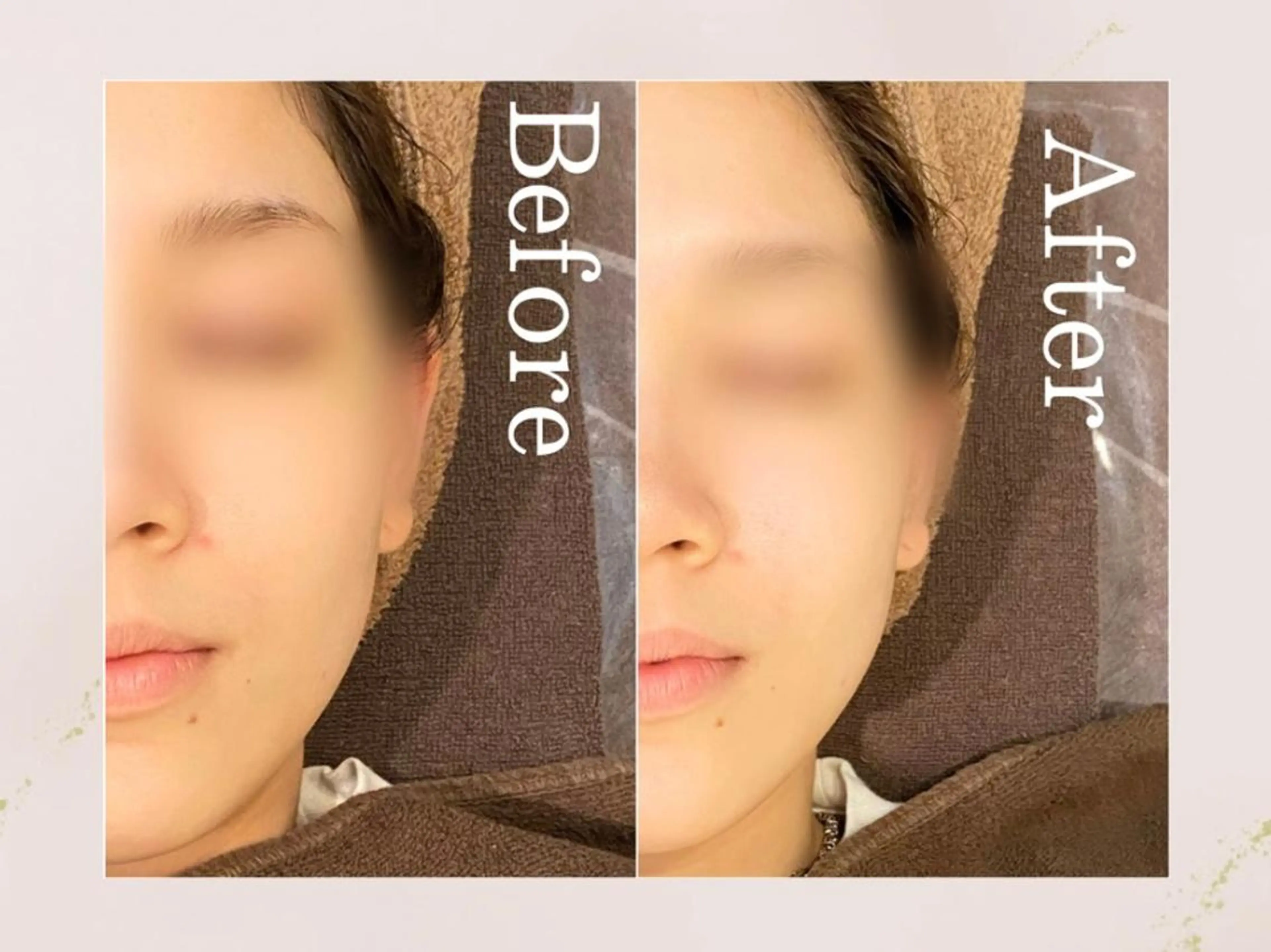 【パーソナルfacial★毛穴ケア×小顔×美肌⠀】欲張りコースの写真