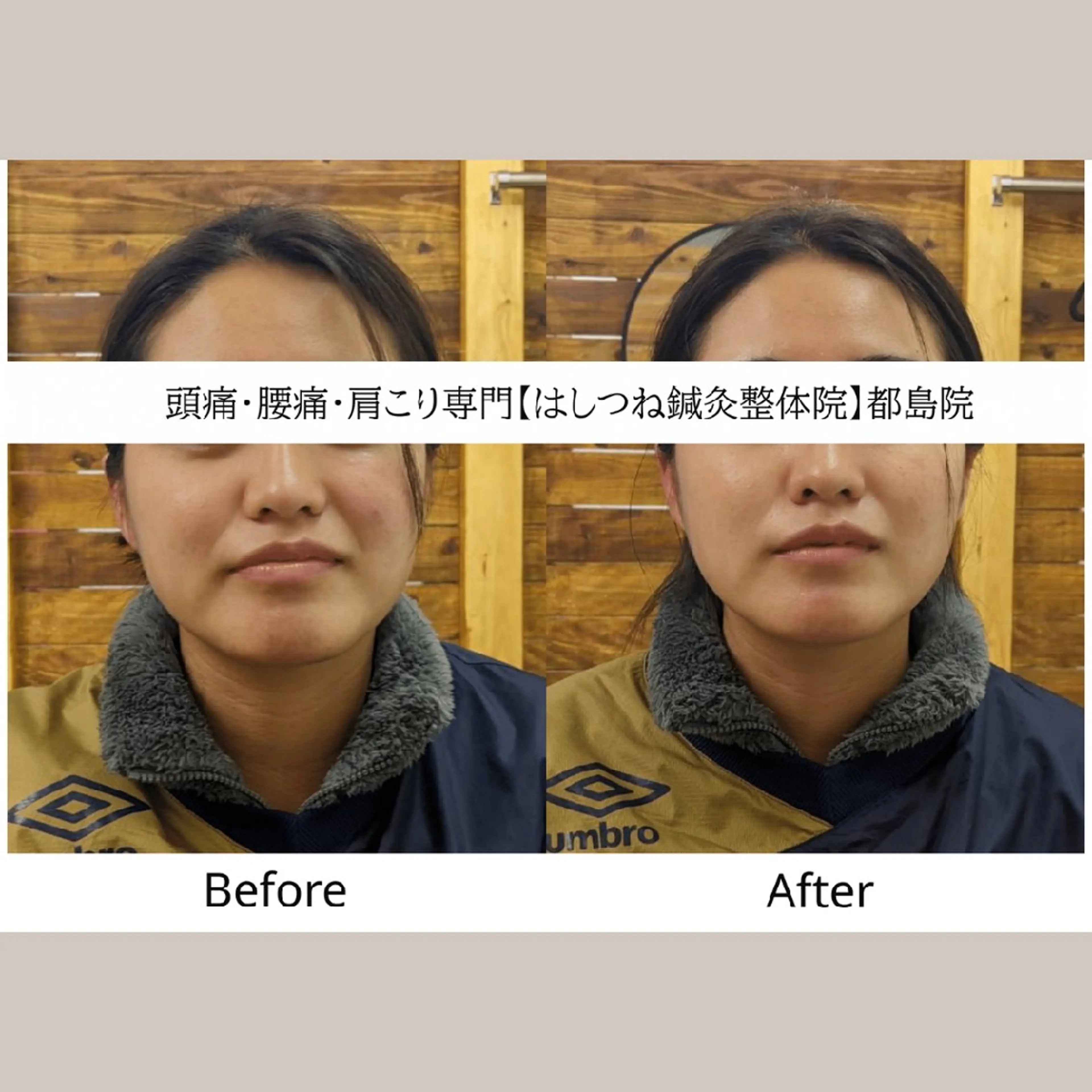 リラク 頭痛・腰痛・美容鍼に 特化してます。　橋岡のエステ・リラクイメージ